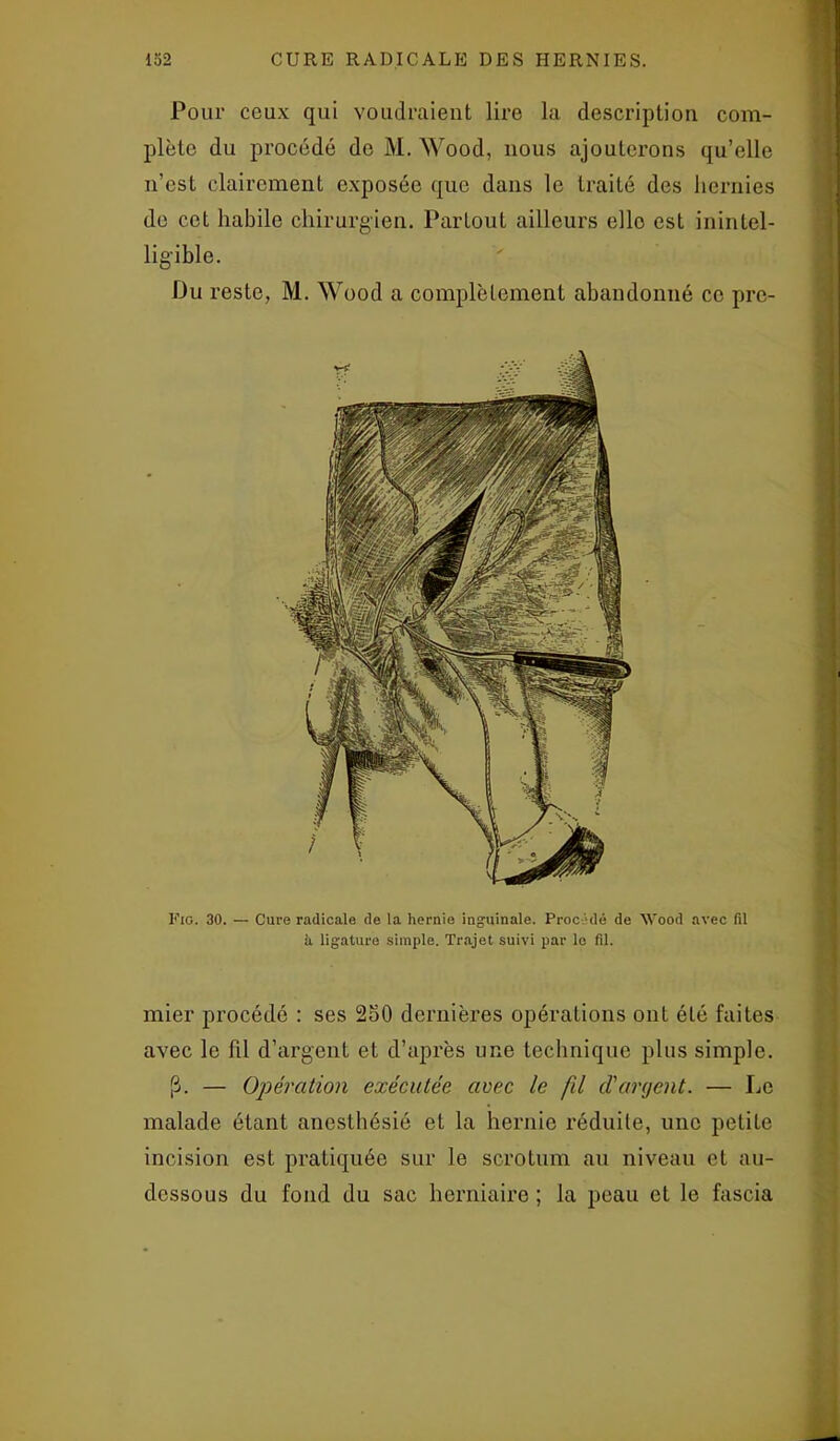 Pour ceux qui voudraient lire la description com- plète du procédé de M. Wood, nous ajouterons qu’elle n’est clairement exposée que dans le traité des hernies de cet habile chirurgien. Partout ailleurs elle est inintel- ligible. Du reste, M. Wood a complètement abandonné ce pre- Fig. 30. — Cure radicale de la hernie inguinale. Procédé de Wood avec fil à ligature simple. Trajet suivi par le fil. mier procédé : ses 250 dernières opérations ont été faites avec le fil d’argent et d’après une technique plus simple. — Opération exécutée avec le fil cl'argent. — Le malade étant anesthésié et la hernie réduite, une petite incision est pratiquée sur le scrotum au niveau et au- dessous du fond du sac herniaire ; la peau et le fascia