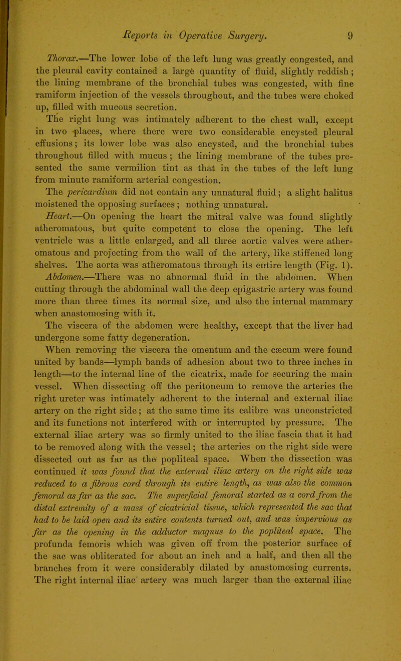 Thorax.—The lower lobe of the loft lung was greatly congested, and the pleural cavity contained a large quantity of fluid, slightly reddish; the lining membrane of the bronchial tubes was congested, with fine ramiforin injection of the vessels throughout, and the tubes were choked up, filled with mucous secretion. The right lung was intimately adherent to the chest wall, except in two places, where there were two considerable encysted pleural effusions; its lower lobe was also encysted, and the bronchial tubes throughout filled with mucus ; the lining membrane of the tubes pre- sented the same vermilion tint as that in the tubes of the left lung from minute ramiform arterial congestion. The pericardium did not contain any unnatural fluid; a slight halitus moistened the opposing surfaces ; nothing unnatural. Heart.—On opening the heart the mitral valve was found slightly atheromatous, but quite competent to close the opening. The left ventricle was a little enlarged, and all three aortic valves were ather- omatous and projecting from the wall of the artery, like stiffened long shelves. The aorta was atheromatous through its entire length (Fig. 1). Abdomen.—There was no abnormal fluid in the abdomen. When cutting through the abdominal wall the deep epigastric artery was found more than three times its normal size, and also the internal mammary when anastomosing with it. The viscera of the abdomen were healthy, except that the liver had undergone some fatty degeneration. When removing the viscera the omentum and the ccecum were found united by bands—lymph bands of adhesion about two to three inches in length—-to the internal line of the cicatrix, made for securing the main vessel. When dissecting off the peritoneum to remove the arteries the right ureter was intimately adherent to the internal and external iliac artery on the right side; at the same time its calibre was unconstricted and its functions not interfered with or interrupted by pressure. The external iliac artery was so firmly united to the iliac fascia that it had to be removed along with the vessel; the arteries on the right side were dissected out as far as the popliteal space. When the dissection was continued it was found that the external iliac artery on the right side ivas reduced to a fibrous cord through its entire length, as was also the common femoral as far as the sac. The superficial femoral started as a cord from the distal extremity of a mass of cicatricial tissue, which represented the sac that had to be laid open and its entire contents turned out, and was impervious as far as the opening in the adductor magnus to the popliteal space. The profunda femoris which was given off from the posterior surface of the sac was obliterated for about an inch and a half, and then all the branches from it were considerably dilated by anastomosing currents. The right internal iliac artery was much larger than the external iliac