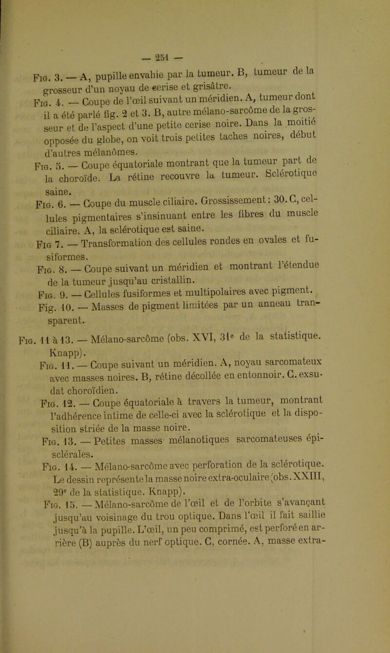 — 231 — Fig. 3. — A, pupille envahie par la tumeur. B, lumeur de la grosseur d’un noyau de «erise et grisâtre. Fig. 4. — Coupe de l’œil suivant un méridien. A, tumeur dont il a été parlé fig. 2 et 3. B, autre mélano-sarcôme de la gros- seur et de l’aspect d’une petite cerise noire. Dans la moitié opposée du globe, on voit trois petites taches noires, début d’autres mélanomes. Fig. o. — Coupe équatoriale montrant que la tumeur part ce la choroïde. La rétine recouvre la tumeur. Sclérotique saine. . Fig. 6. — Coupe du muscle ciliaire. Grossissement: 30.G, cel- lules pigmentaires s’insinuant entre les fibres du muscle ciliaire. A, la sclérotique est saine. pIG 7_ — Transformation des cellules rondes en ovales et fu- siformes. Fig. 8. — Coupe suivant un méridien et montrant 1 étendue de la tumeur jusqu’au cristallin. Fig. 9. — Cellules fusiformes et multipolaires avec pigment. Fig. 10. — Masses de pigment limitées par un anneau tran- sparent. Fig. 11 à 13. — Mélano-sarcôme (obs. XVI, 31e de la statistique. Knapp). Fîg. il. — Coupe suivant un méridien. A, noyau sarcomateux avec masses noires. B, rétine décollée en entonnoir. C. exsu- dât choroïdien. Fig. 12. — Coupe équatoriale à travers la tumeur, montrant l’adhérence intime de celle-ci avec la sclérotique et la dispo- sition striée de la masse noire. Fig. 13. — Petites masses mélanotiques sarcomateuses épi- sclérales. Fig. 14. — Mélano-sarcôme avec perforation de la sclérotique. Le dessin représentela massenoireextra-oculaire vobs.XXIII, 29e de la statistique. Knapp). Fig. 13. — Mélano-sarcôme de l’œil et de l’orbite s’avançant jusqu’au voisinage du trou optique. Dans 1 œil il lait saillie jusqu’à la pupille. L’œil, un peu comprimé, est perforé en ar- rière (B) auprès du nerf optique. C, cornée. A, masse extra-