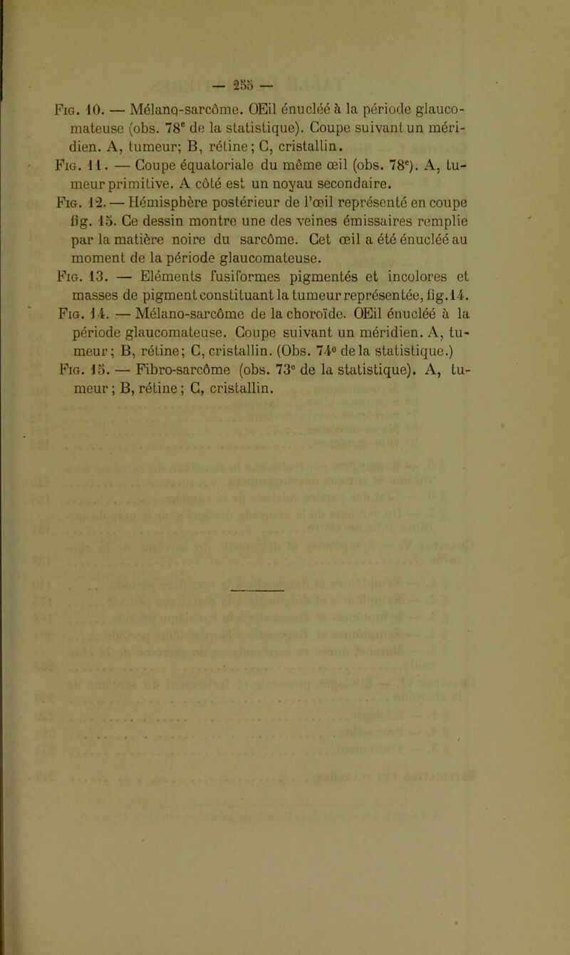 Fig. 10. — Mélanq-sarcôme. OEil énucléé à la période glauco- mateuse (obs. 78° de la statistique). Coupe suivant un méri- dien. A, tumeur; B, rétine; C, cristallin. Fig. 11. — Coupe équatoriale du môme œil (obs. 78e). A, tu- meur primitive. A côté est un noyau secondaire. Fig. 12. — Hémisphère postérieur de l’œil représenté en coupe lig. 15. Ce dessin montre une des veines émissaires remplie par la matière noire du sarcome. Cet œil a été énucléé au moment de la période glaucomateuse. Fig. 13. — Eléments fusiformes pigmentés et incolores et masses de pigment constituant la tumeur représentée, tig. l-i. Fig. 14. —Mélano-sarcôme de la choroïde. OEil énucléé à la période glaucomateuse. Coupe suivant un méridien. A, tu- meur; B, rétine; C, cristallin. (Obs. 74e delà statistique.) Fig. 15. — Fibro-sarcôme (obs. 73e de la statistique). A, tu- meur ; B, rétine ; C, cristallin.