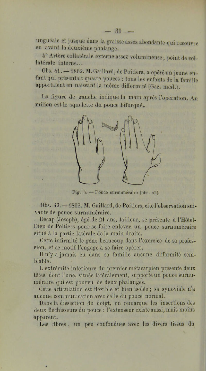 unguéale et jusque dans la graisse assez abondante qui recouvre en avant la deuxième phalange. i° Artère collatérale externe assez volumineuse; point de col- latérale interne... Obs. M. —1862. M.Gaillard, de Poitiers, a opéréun jeune en- fant qui présentait quatre pouces : tous les enfants de la famille apportaient en naissant la môme difformité (Gaz. méd.). La figure de gauche indique la main après l’opération. Au milieu est le squelette du pouce bifurqué. Fig. 5. — Pouce surnuméraire (obs. 42). Obs. 42.—1862. M. Gaillard, de Poitiers, cite l’observation sui- vante de pouce surnuméraire. Decap (Joseph), âgé de 21 ans, tailleur, se présente à l’Hôtel- Dieu de Poitiers pour se faire enlever un pouce surnuméraire situé à la partie latérale de la main droite. Cette infirmité le gène beaucoup dans l’exercice de sa profes- sion, et ce motif l’engage à se faire opérer. Il n’v a jamais eu dans sa famille aucune difformité sem- blable. L’extrémité inférieure du premier métacarpien présente deux têtes, dont l’une, située latéralement, supporte un pouce surnu- méraire qui est pourvu de deux phalanges. Lette articulation est flexible et bien isolée ; sa synoviale n’a aucune communication avec celle du pouce normal. Dans la dissection du doigt, on remarque les insertions des deux fléchisseurs du pouce ; l’extenseur existe aussi, mais moins apparent. Les fibres , un peu confondues avec les divers tissus du