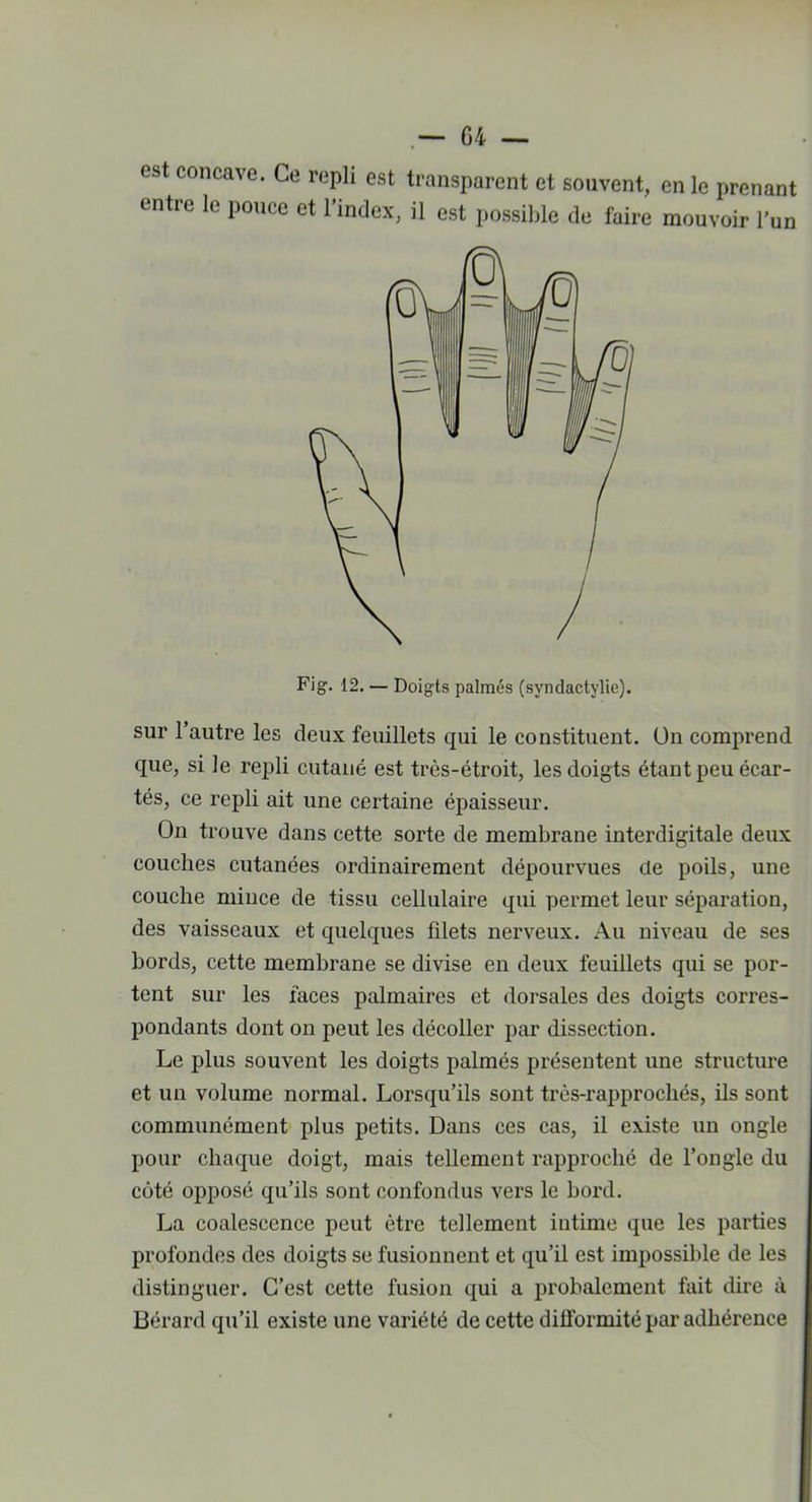 est concave. Ce repli est transparent et souvent, en le prenant entre le pouce et l’index, il est possible de faire mouvoir l’un Fig. 12. — Doigts palmés (svndactylie). sur l’autre les deux feuillets qui le constituent, ün comprend que, si le repli cutané est très-étroit, les doigts étant peu écar- tés, ce repli ait une certaine épaisseur. On trouve dans cette sorte de membrane interdigitale deux couches cutanées ordinairement dépourvues de poils, une couche mince de tissu cellulaire qui permet leur séparation, des vaisseaux et quelques filets nerveux. Au niveau de ses bords, cette membrane se divise en deux feuillets qui se por- tent sur les faces palmaires et dorsales des doigts corres- pondants dont on peut les décoller par dissection. Le plus souvent les doigts palmés présentent une structure et un volume normal. Lorsqu’ils sont très-rapprochés, ils sont communément plus petits. Dans ces cas, il existe un ongle pour chaque doigt, mais tellement rapproché de l’ongle du côté opposé qu’ils sont confondus vers le bord. La coalescence peut être tellement intime que les parties profondes des doigts se fusionnent et qu’il est impossible de les distinguer. C’est cette fusion qui a probalement fait dire à Bérard qu’il existe une variété de cette dilformité par adhérence