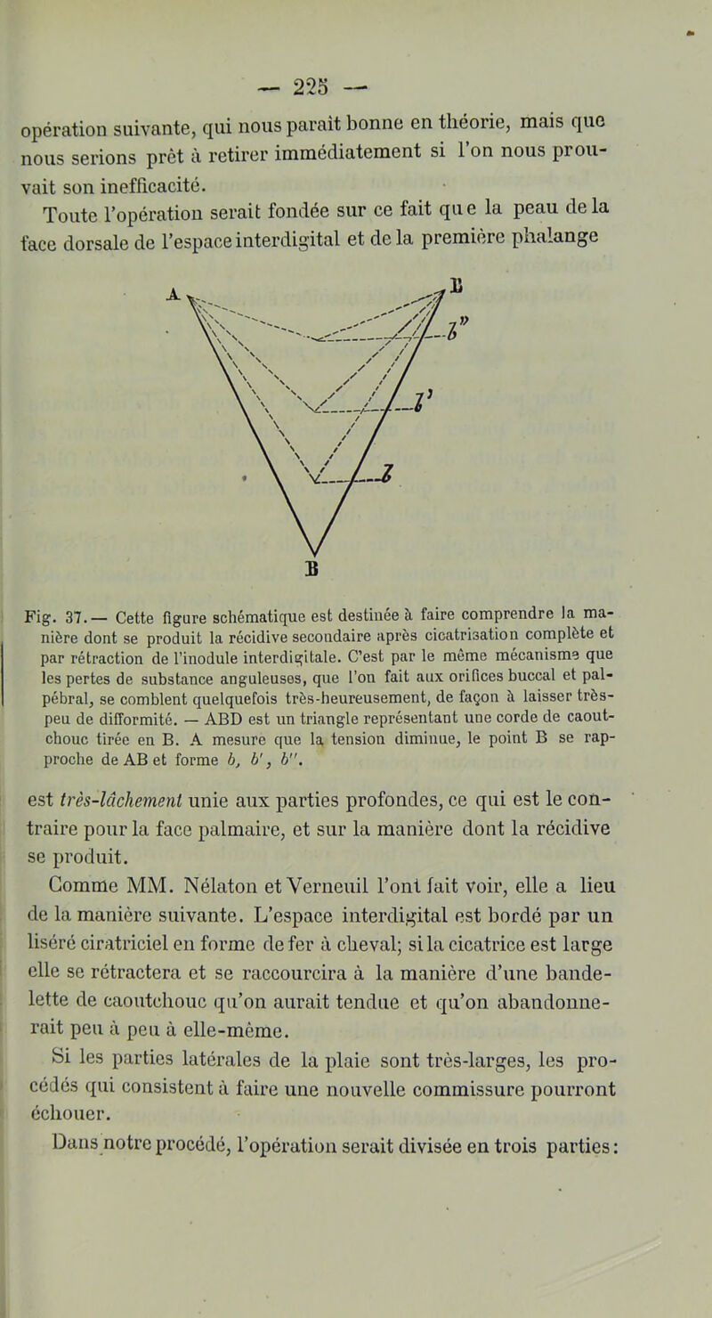 opération suivante, qui nous parait bonne en théorie, mais que nous serions prêt à retirer immédiatement si 1 on nous pr ou- vait son inefficacité. Toute l’opération serait fondée sur ce fait que la peau delà face dorsale de l’espace interdigital et delà première phalange Fig. 37.— Cette figure schématique est destinée à faire comprendre la ma- nière dont se produit la récidive secondaire après cicatrisation complète et par rétraction de l’inodule interdigitale. C’est par le même mécanisme que les pertes de substance anguleuses, que l’on fait aux orifices buccal et pal- pébral, se comblent quelquefois très-heureusement, de façon à laisser très- peu de difformité. — ABD est un triangle représentant une corde de caout- chouc tirée en B. A mesure que la tension diminue, le point B se rap- proche de AB et forme b, b', b. est très-lâchement unie aux parties profondes, ce qui est le con- traire pour la face palmaire, et sur la manière dont la récidive se produit. Gomme MM. Nélaton et Verneuil l’ont fait voir, elle a lieu de la manière suivante. L’espace interdigital est bordé par un liséré ciratriciel en forme de fer à cheval; si la cicatrice est large elle se rétractera et se raccourcira à la manière d’une bande- lette de caoutchouc qu’on aurait tendue et qu’on abandonne- rait peu à peu à elle-même. Si les parties latérales de la plaie sont très-larges, les pro- cédés qui consistent à faire une nouvelle commissure pourront échouer. Dans notre procédé, l’opération serait divisée en trois parties :