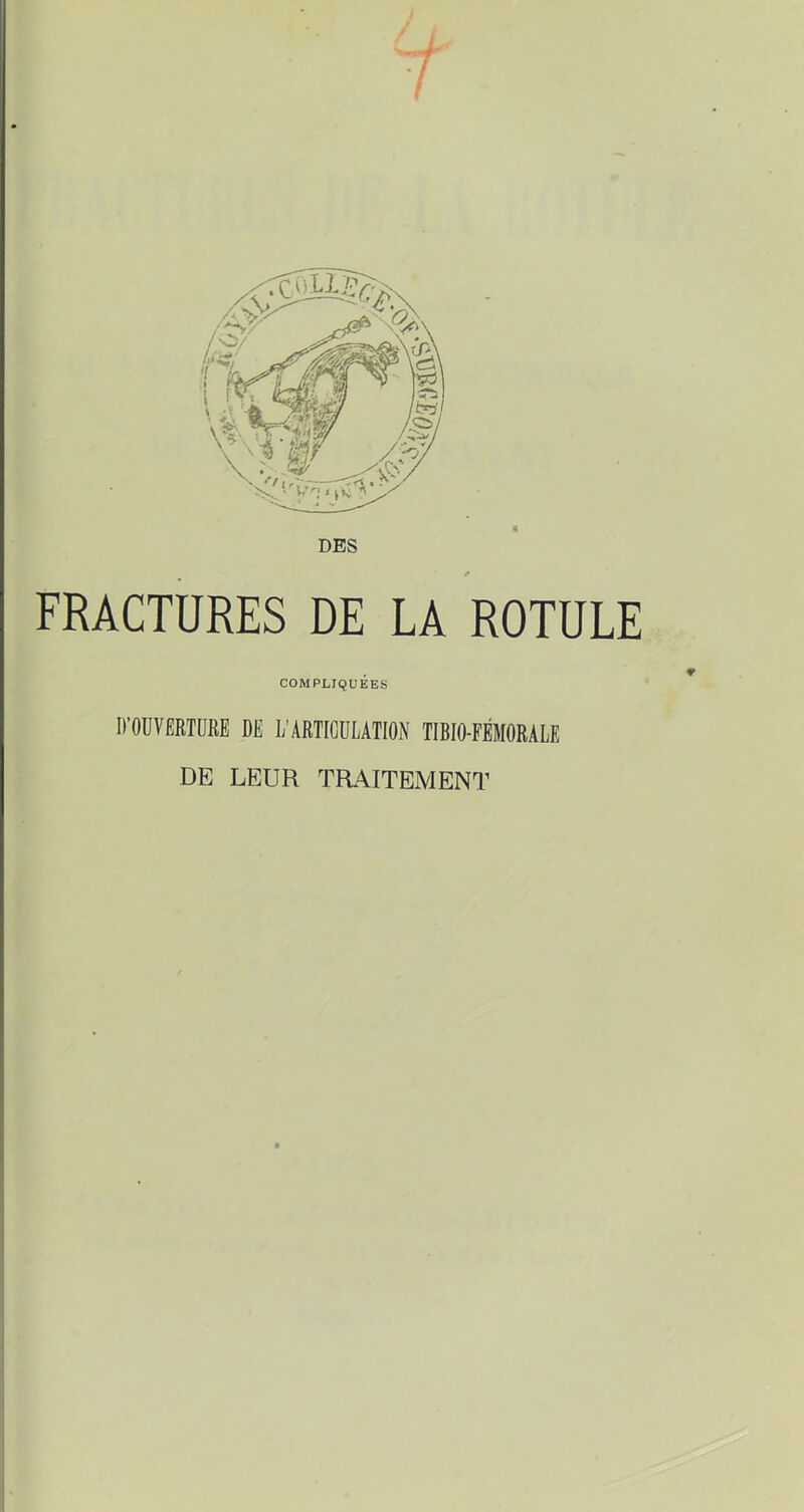 I FRACTURES DE LA ROTULE COMPLIQUÉES D’OUVERTURE DE L’ARTICULATION TIBIO-FÉMORALE DE LEUR TRAITEMENT