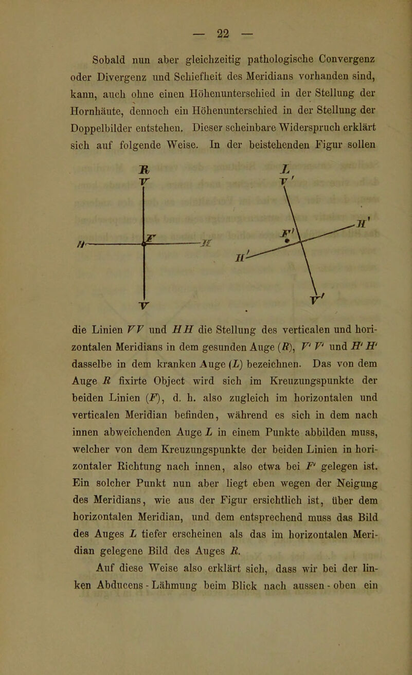 Sobald nun aber gleichzeitig pathologische Convergenz oder Divergenz und Schiefheit des Meridians vorhanden sind, kann, auch ohne einen Höhenunterschied in der Stellung der Hornhäute, dennoch ein Höhenunterschied in der Stellung der Doppelbilder entstehen. Dieser scheinbare Widerspruch erklärt sich auf folgende Weise. In der beistehenden Figur sollen M X V T ' die Linien ff ff und HH die Stellung des verticalen und hori- zontalen Meridians in dem gesunden Auge (ff), ff' ff' und H‘ H‘ dasselbe in dem kranken Auge (L) bezeichnen. Das von dem Auge ff fixirte Object wird sich im Kreuzungspunkte der beiden Linien (ff), d. h. also zugleich im horizontalen und verticalen Meridian befinden, während es sich in dem nach innen abweichenden Auge L in einem Punkte abbilden muss, welcher von dem Kreuzungspunkte der beiden Linien in hori- zontaler Richtung nach innen, also etwa bei ff' gelegen ist. Ein solcher Punkt nun aber liegt eben wegen der Neigung des Meridians, wie aus der Figur ersichtlich ist, über dem horizontalen Meridian, und dem entsprechend muss das Bild des Auges L tiefer erscheinen als das im horizontalen Meri- dian gelegene Bild des Auges ff. Auf diese Weise also erklärt sich, dass wir bei der lin- ken Abducens - Lähmung beim Blick nach aussen - oben ein