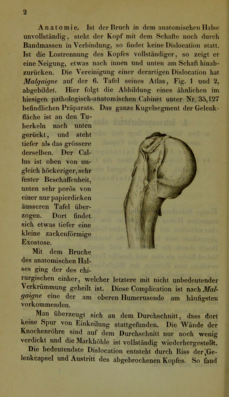 Anatomie. Ist der Bruch in dem anatomischen Halse unvollständig, steht der Kopf mit dem Schafte noch durch Bandmassen in Verbindung, so findet keine Dislocation statt. Ist die Lostrennung des Kopfes vollständiger, so zeigt er eine Neigung, etwas nach innen und unten am Schaft hinab- zurücken. Die Vereinigung einer derartigen Dislocation hat Malgaigne auf der 6. Tafel seines Atlas, Fig. 1 und 2, abgebildet. Hier folgt die Abbildung eines ähnlichen im hiesigen pathologisch-anatomischen Cabinet unter Nr. 35,127 befindlichen Präparats. Das ganze Kugelsegment der Gelenk- fläche ist an den Tu- berkeln nach unten gerückt, und steht tiefer als das grössere derselben. Der Gal- lus ist oben von un- gleich höckeriger, sehr fester Beschafltenheit, unten sehr porös von einer nur papierdicken äusseren Tafel über- zogen. Dort findet sich etwas tiefer eine kleine zackenförmige Exostose. Mit dem Bruche des anatomischen Hal- ses ging der des chi- rurgischen einher, welcher letztere mit nicht unbedeutender Verkrümmung geheilt ist. Diese Complication ist nach Mal- gaigne eine der am oberen Humerusende am häufigsten vorkommenden. Man überzeugt sich an dem Durchschnitt, dass dort keine Spur von Einkeilung stattgefunden. Die Wände der Knochenröhre sind auf dem Durchschnitt nur noch wenig verdickt und die Markhöhle ist vollständig wiederhergestellt. Die bedeutendste Dislocation entsteht durch Biss der'Ge- lenkcapsel und Austritt des abgebrochenen Kopfes. So fand
