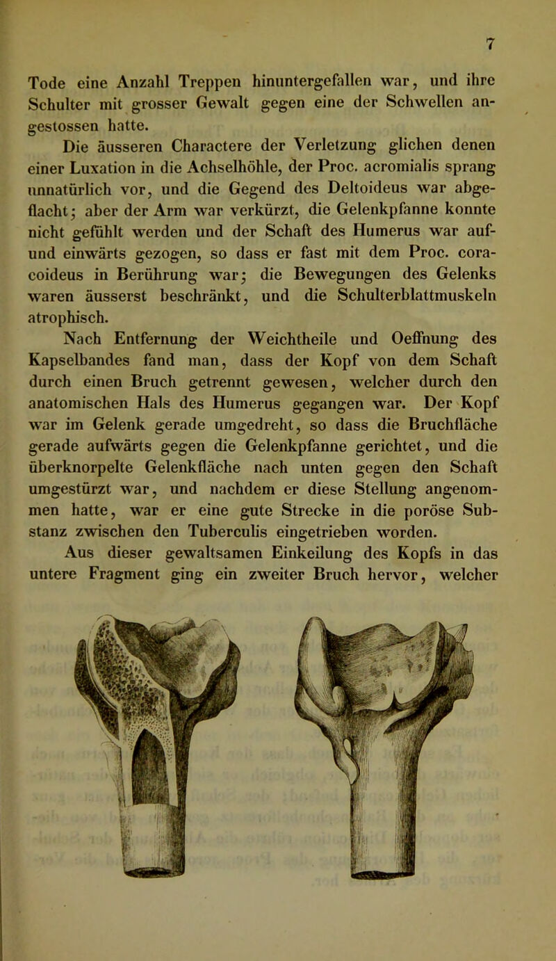 r Tode eine Anzahl Treppen hinuntergefallen war, und ihre Schulter mit grosser Gewalt gegen eine der Schwellen an- geslossen hatte. Die äusseren Charactere der Verletzung glichen denen einer Luxation in die Achselhöhle, der Proc. acromialis sprang unnatürlich vor, und die Gegend des Deltoideus war abge- flacht j aber der Arm war verkürzt, die Gelenkpfanne konnte nicht gefühlt werden und der Schaft des Humerus war auf- und einwärts gezogen, so dass er fast mit dem Proc. cora- coideus in Berührung war; die Bewegungen des Gelenks waren äusserst beschränkt, und die Schulterblattmuskeln atrophisch. Nach Entfernung der Weichtheile und Oeffnung des Kapselbandes fand man, dass der Kopf von dem Schaft durch einen Bruch getrennt gewesen, welcher durch den anatomischen Hals des Humerus gegangen war. Der Kopf war im Gelenk gerade umgedreht, so dass die Bruchfläche gerade aufwärts gegen die Gelenkpfanne gerichtet, und die überknorpelte Gelenkfläche nach unten gegen den Schaft umgestürzt war, und nachdem er diese Stellung angenom- men hatte, war er eine gute Strecke in die poröse Sub- stanz zwischen den Tuberculis eingetrieben worden. Aus dieser gewaltsamen Einkeilung des Kopfs in das untere Fragment ging ein zweiter Bruch hervor, welcher