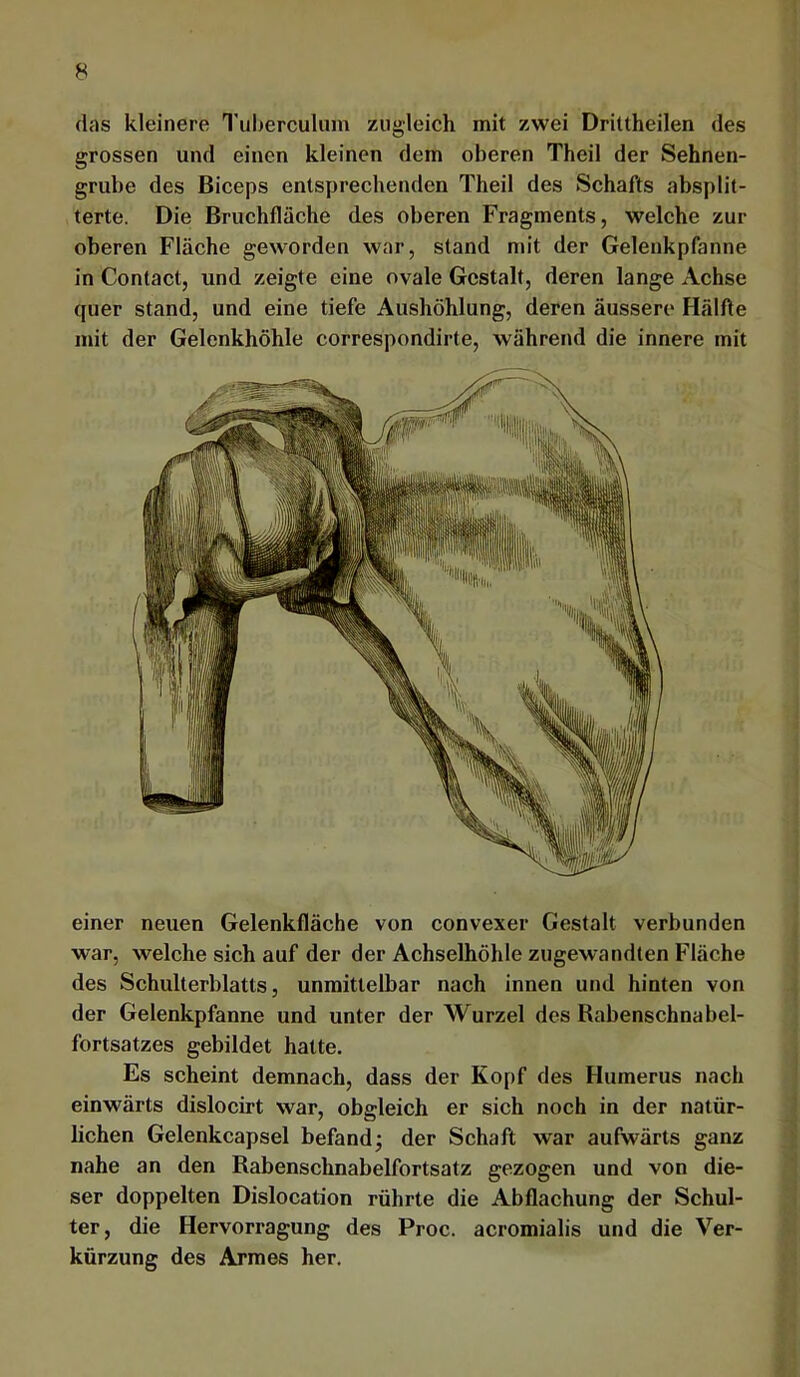(las kleinere Tuljerculiim zugleich mit zwei Drittheilen des grossen und einen kleinen dem oberen Theil der Sehnen- grube des Biceps entspreehenden Theil des Schafts absplit- terte. Die Bruchfläche des oberen Fragments, welche zur oberen Fläche geworden war, stand mit der Gelenkpfanne in Contact, und zeigte eine ovale Gestalt, deren lange Achse quer stand, und eine tiefe Aushöhlung, deren äussere Hälfte mit der Gelenkhöhle correspondirte, während die innere mit einer neuen Gelenkfläche von convexer Gestalt verbunden war, welche sich auf der der Achselhöhle zugewandten Fläche des Schulterblatts, unmittelbar nach innen und hinten von der Gelenkpfanne und unter der Wurzel des Babenschnabel- fortsatzes gebildet hatte. Es scheint demnach, dass der Kopf des Humerus nach einwärts dislocirt war, obgleich er sich noch in der natür- lichen Gelenkcapsel befandj der Schaft war aufwärts ganz nahe an den Rabenschnabelfortsatz gezogen und von die- ser doppelten Dislocation rührte die Abflachung der Schul- ter, die Hervorragung des Proc. acromialis und die Ver- kürzung des Armes her.