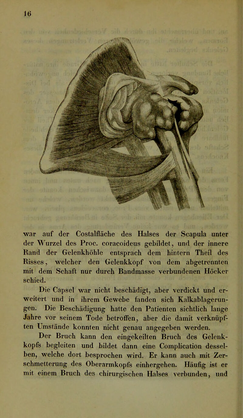 u> war auf der Costalfläche des Halses der Scapula unter der Wurzel des Proc, coracoideus gebildet, und der innere Rand der Gelenkhöhle entsprach dem hintern Theil des Risses, welcher den Gelenkkopf von dem abgelrennten mit dem Schaft nur durch Bandmasse verbundenen Höcker schied. Die Capsel war nicht beschädigt, aber verdickt und er- weitert und in ihrem Gewebe fanden sich Kalkablagerun- gen. Die Beschädigung hatte den Patienten sichtlich lange Jahre vor seinem Tode betroffen, aber die damit verknüpf- ten Umstände konnten nicht genau angegeben werden. Der Bruch kann den eingekeilten Bruch des Gelenk- kopfs begleiten und bildet dann eine Complication dessel- ben, welche dort besprochen wird. Er kann auch mit Zer- schmetterung des Oberarmkopfs einhergehen. Häufig ist er mit einem Bruch des chirurgischen Halses verbunden, und