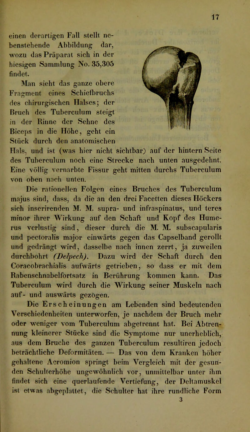 einen derartigen Fall stellt ne- benstehende Abbildung dar, wozu das Präparat sich in der hiesigen Sammlung No. 35,305 findet. Man sieht das ganze obere Fragment eines Schiefbruchs des chirurgischen Halsesj der Bruch des Tuberculum steigt in der Rinne der Sehne des Biceps in die Höhe, geht ein Stück durch den anatomischen Hals, und ist (was hier nicht sichtbar) auf der hintern Seite des Tuberculum noch eine Strecke nach unten ausgedehnt. Eine völlig vernarbte Fissur geht mitten durchs Tuberculum von oben nach unten. Die rationellen Folgen eines Bruches des Tuberculum majus sind, dass, da die an den drei Facetten dieses Höckers sich inserirenden M. M. supra- und infraspinatus, und teres minor ihrer Wirkung auf den Schaft und Kopf des Hume- rus verlustig sind, dieser durch die M. M. subscapularis und pectoralis major einwärts gegen das Capseiband gerollt und gedrängt wird, dasselbe nach innen zerrt, ja zuweilen durchbohrt (Delpech), Dazu wird der Schaft durch den Coracobrachialis aufwärts getrieben, so dass er mit dem Rabenschnabelfortsatz in Berührung kommen kann. Das Tuberculum wird durch die Wirkung seiner Muskeln nach auf- und auswärts gezogen. Die Erscheinungen am Lebenden sind bedeutenden Verschiedenheiten unterworfen, je nachdem der Bruch mehr oder weniger vom Tuberculum abgetrennt hat. Bei Abtren- nung kleinerer Stücke sind die Symptome nur unerheblich, aus dem Bruche des ganzen Tuberculum resultiren jedoch beträchtliche Deformitäten. — Das von dem Kranken höher gehaltene Acroinion springt beim Vergleich mit der gesun- den Schulterhöhe ungewöhnlich vor, unmittelbar unter ihm findet sich eine querlaufende Vertiefung, der Deltamuskel ist etwas abgeplattet, die Schulter hat ihre rundliche Form 3