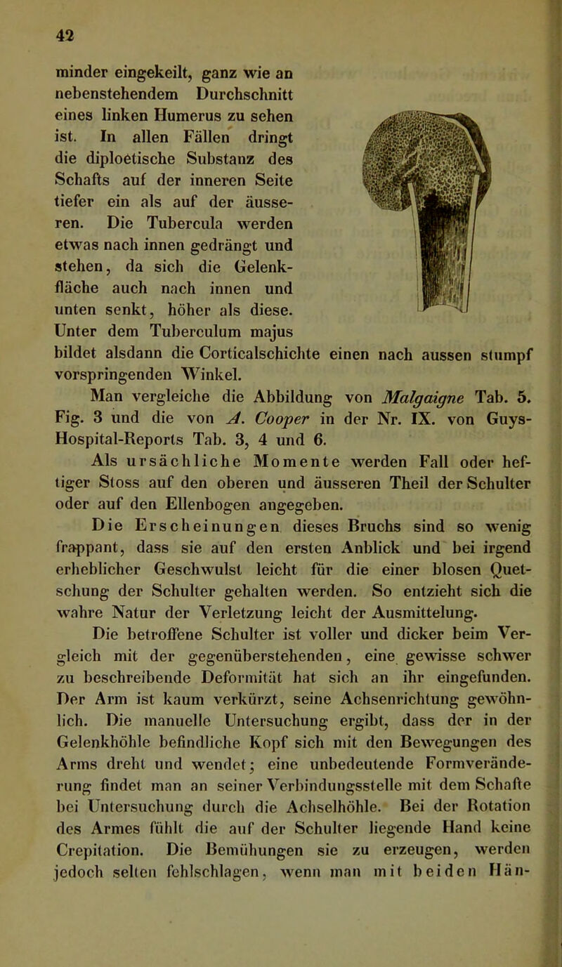 minder eingekeilt, ganz wie an nebenstehendem Durchschnitt eines linken Humerus zu sehen ist. In allen Fällen dringt die diploetische Substanz des Schafts auf der inneren Seite tiefer ein als auf der äusse- ren. Die Tubercula werden etwas nach innen gedrängt und stehen, da sich die Gelenk- fläche auch nach innen und unten senkt, höher als diese. Unter dem Tuberculum majus bildet alsdann die Corticalschichte einen nach aussen stumpf vorspringendeii Winkel. Man vergleiche die Abbildung von Malgaigne Tab. 5. Fig. 3 und die von A. Cooper in der Nr. IX. von Guys- Hospital-Reports Tab. 3, 4 und 6. Als ursächliche Momente werden Fall oder hef- tiger Stoss auf den oberen und äusseren Theil der Schulter oder auf den Ellenbogen angegeben. Die Erscheinungen dieses Bruchs sind so wenig frappant, dass sie auf den ersten Anblick und bei irgend erheblicher Geschwulst leicht für die einer blosen Quet- schung der Schulter gehalten werden. So entzieht sich die wahre Natur der Verletzung leicht der Ausmittelung. Die betroffene Schulter ist voller und dicker beim Ver- gleich mit der gegenüberstehenden, eine gewisse schwer zu beschreibende Deformität hat sich an ihr eingefunden. Der Arm ist kaum verkürzt, seine Achsenrichtung gewöhn- lich. Die manuelle Untersuchung ergibt, dass der in der Gelenkhöhle befindliche Kopf sich mit den Bewegungen des Arms dreht und wendet j eine unbedeutende Formverände- rung findet man an seiner Verbindungsstelle mit dem Schafte bei Untersuchung durch die Achselhöhle. Bei der Rotation des Armes fühlt die auf der Schulter liegende Hand keine Crepitation. Die Bemühungen sie zu erzeugen, werden jedoch selten fchlschlagen, wenn man mit beiden IIän-
