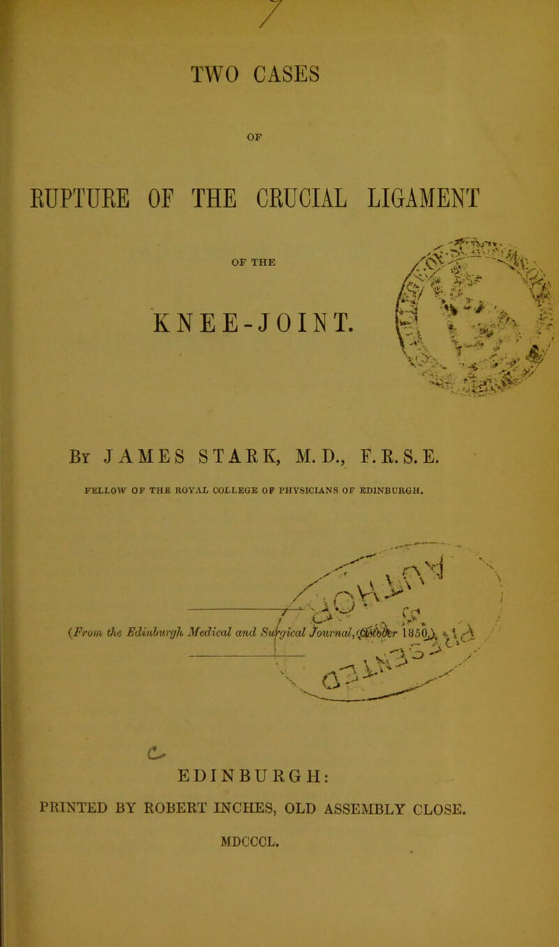 / TWO CASES EUPTURE OF THE CRUCIAL LIGAMENT OF THE KNEE-JOINT. By JAMES STARK, M. D., F.R.S.E. FELLOW OP THE ROYAL COLLEGE OF PHYSICIANS OF EDINBURGH. {From the Edinburgh Medical a/nd Sulgical J'ournal,<'j3idi)^br 1850;), \ (A V Cf: c. EDINBURGH: PRINTED BY ROBERT INCHES, OLD ASSEMBLY CLOSE. MDCCCL.