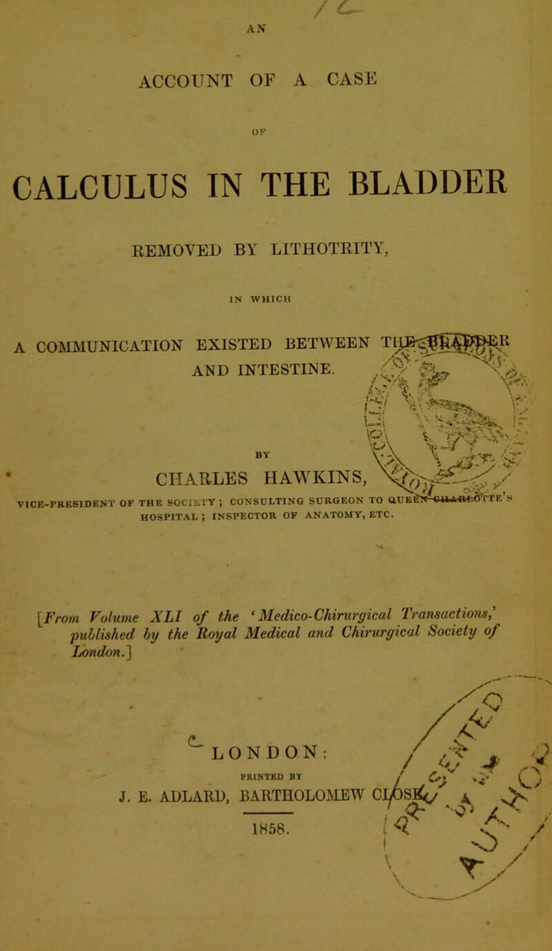 ACCOUNT OF A CASE OF CALCULUS IN THE BLADDER V * ur mu CVV1U** j ‘ HOSPITAL i INSPECTOR OF ANATOMY, ETC. [From Volume A'LI of the 1 Medico-Chirurgical Transactions,' 'published by the Royal Medical and Chirurgical Society of London.] REMOVED BY LITHOTRITY, IN WHICH J. E. ADLARD, BARTHOLOMEW C PRINTED BY 1858.