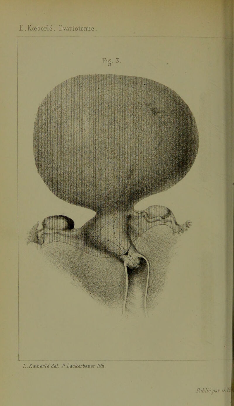 E . Koeterlé . Ovaviolomie. Eig, 3. r> Ir ; V E. Kæberlé del, P. [.ackerbuuar lith. Publié par JB