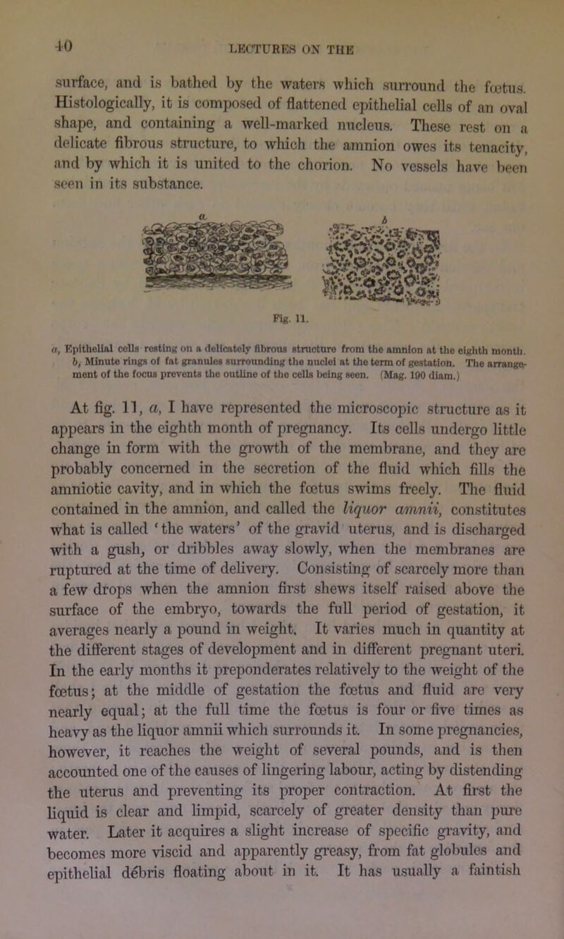 -10 surface, and is bathed by the waters whicli suiTound the fa'tns. Histologically, it is composed of flattened epithelial cells of an oval shape, and containing a well-marked nnclens. These rest on a delicate fibrous structure, to which the amnion owes its tenacity, and by which it is united to the chorion. No vessels have been seen in its substance. a, Kpltheliftl cells resting on a delicately fibrous structure from the amnion at tlie eighth month. 6, Minute rings of fat granules surrounding the nuclei at the term of gestation. Tlie arrange- ment of the focus prevents the outline of the cells being seen. (Mag. 100 diam.) At fig. 11, a, I have represented the microscopic stnicture as it appears in the eighth month of pregnancy. Its cells undergo little change in form with the growth of the membrane, and they are probably concerned in the secretion of the fluid which fills the amniotic cavity, and in which the foetus swims freely. Tlie fluid contained in the amnion, and called the liquor amnii, constitutes what is called ‘the waters’ of the gravid uterus, and is discharged with a gush^ or dribbles away slowly, when the membranes are ruptured at the time of delivery. Consisting of scarcely more than a few drops when the amnion first shews itself raised above the surface of the embryo, towards the full period of gestation, it averages nearly a pound in weight. It varies much in quantity at the different stages of development and in different pregnant uteri. In the early months it jireponderates relatively to the weight of the foetus; at the middle of gestation the foetus and fluid are very nearly equal; at the fuU time the foetus is four or five times as heavy as the liquor amnii which surrounds it. In some pregnancies, however, it reaches the weight of several pounds, and is then accounted one of the causes of lingering labour, acting by distending the uterus and preventing its proper contraction. At first the liquid is clear and limpid, scarcely of greater density than pure water. Later it acquires a slight increase of specific gravity, and becomes more viscid and apparently greasy, from fat globules and epithelial debris floating about in it. It has u.sually a faintLsh a A
