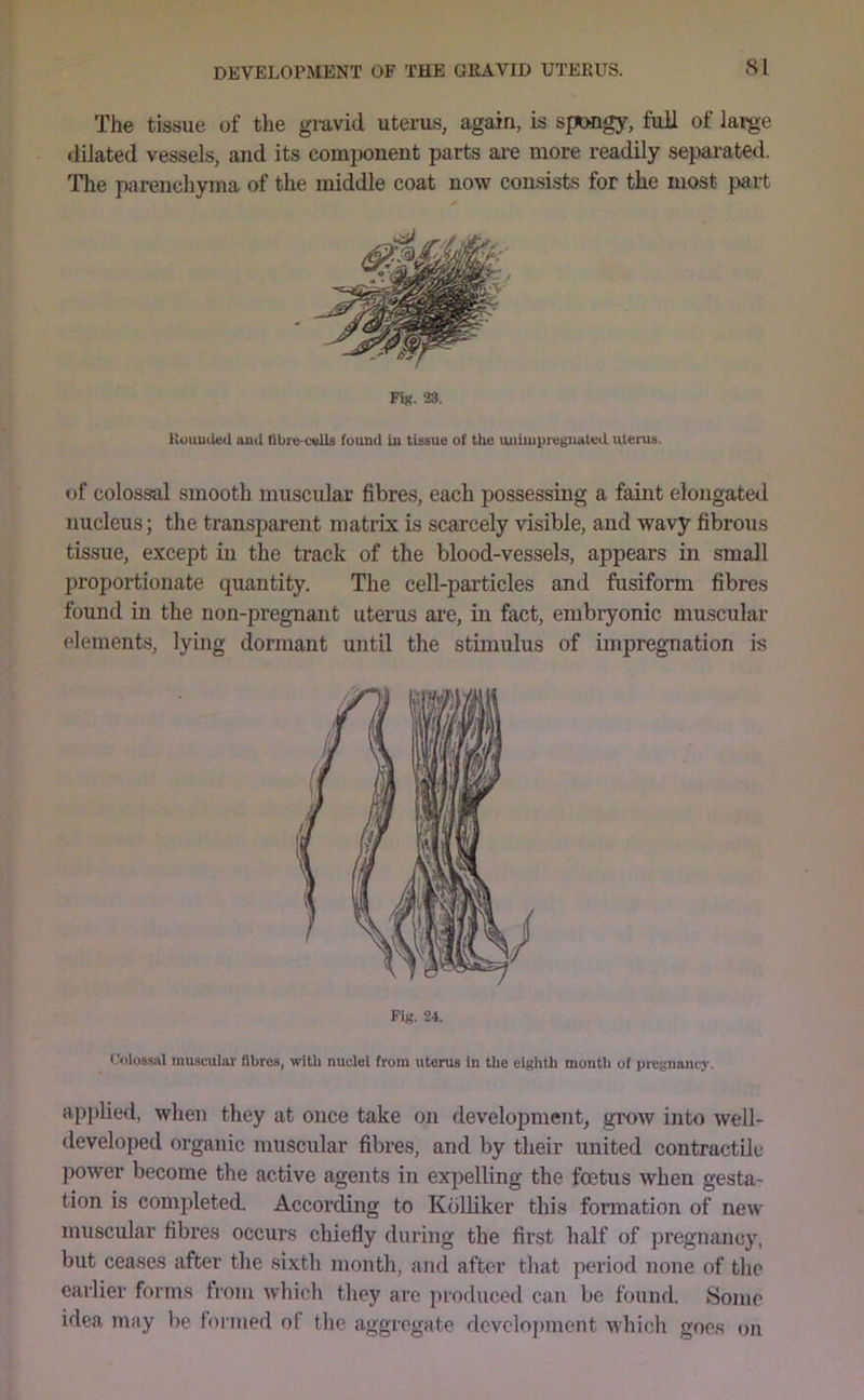 The tissue of the gravid uterus, again, is spongy, full of large dilated vessels, and its component parts ai'e more readily sepai-ated. The parenchyma of the middle coat now consists for the most part of colossal smooth muscular fibres, each possessing a faint elongated nucleus; the transparent matrix is scarcely visible, and wavy fibrous tissue, except in the track of the blood-vessels, appears in small proportionate quantity. The cell-particles and fusiform fibres found in the non-pregnant uterus are, in fact, embryonic muscular elements, lying dormant until the stimulus of impregnation is Colossal muscular fibres, with nuclei from uterus in the eighth month of prcgnancj-. applied, when they at once take on development, grow into well- developed organic muscular fibres, and by their united contractile power become the active agents in expelling the foetus when gesta- tion is completed. According to KoUiker this formation of new muscular fibres occurs chiefly diu’ing the first half of pregnancy, but ceases after the sixth month, and after that period none of the earlier forms from which they are produced can be found. Some idea may be lormed ot the aggregate dcvelojnnent ^Yhich goes on Fig. 33. liuuuiled anil tlbre-cvlls found in tissue of the uuimpreguat«d uterus. Fig. 24.