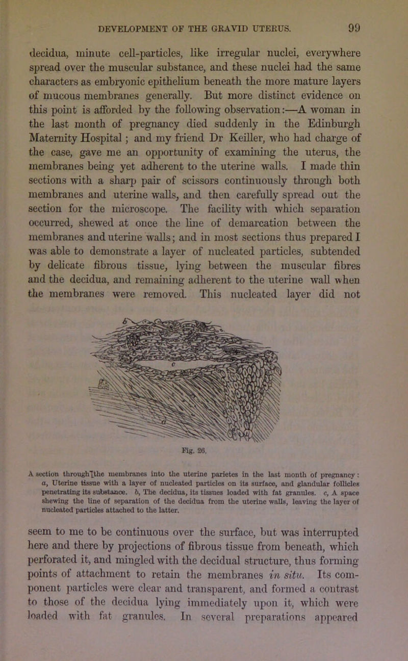 decidua, minute cell-pai-ticles, like irregular nuclei, everywhere spread over the muscular substance, and these nuclei had the same characters as embryonic epithelium beneath the more mature layers of mucous membranes generally. But more distinct evidence on this point is afforded by the following observation:—A woman in the last month of pregnancy died suddenly in the Edinburgh Maternity Hospital; and my friend Dr KeiUer, who had charge of the case, gave me an opportunity of examining the uterus, the membranes being yet adherent to the uterine walls. I made thin sections with a sharp pair of scissors continuously through both membranes and uterine walls, and then cai’efully spread out the section for the microscope. The facility with which sepaiution occurred, shewed at once the luie of demarcation between the membranes and uterine walls; and in most sections thus prepared I was able to demonstrate a layer of nucleated particles, subtended by delicate fibrous tissue, lying between the muscular fibres and the decidua, and remaining adherent to the uterine wall when the membranes were removed. This nucleated layer did not Fig. 26. A section tUroughTthe membranes into the uterine parietes in the last month of pregnancy: a, Uterine tissue with a layer of nucleated particles on its surface, and glandular follicles penetrating its substance. 6, The decidua, its tissues loaded with fat granTiles. c, A space shewing the line of separation of the decidua from the uterine walls, leaving the layer of nucleated particles attached to the latter. seem to me to be continuous over the stuface, but was interrupted here and there by projections of fibrous tissue from beneath, which perforated it, and mingled with the decidual structure, thus forming points of attachment to retain the membranes in situ. Its com- ponent jiarticles were clear and transparent, and formed a contrast to those of the decidua lying immediately upon it, 'W'hich w'ere loaded w'ith fat granules. In several preparations appeared