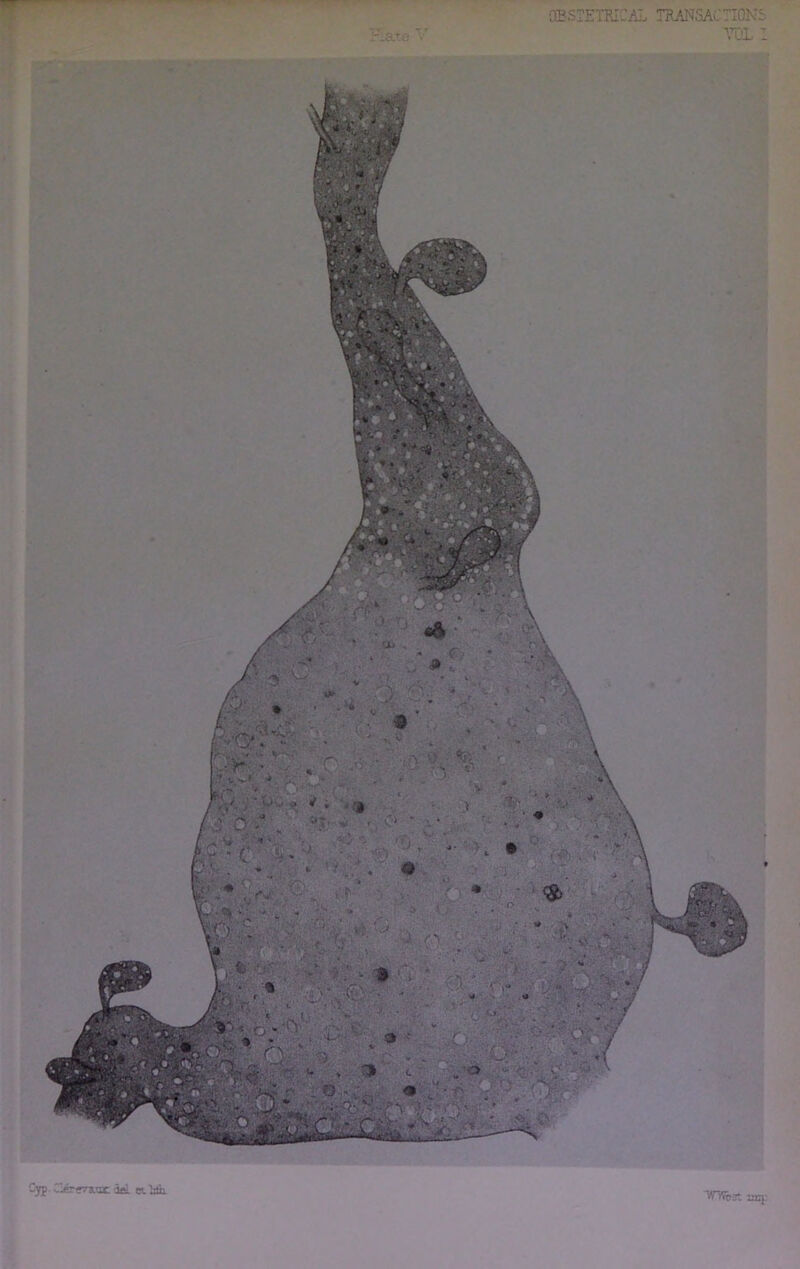 OBSTETRICAL TRANSACTIONS m i