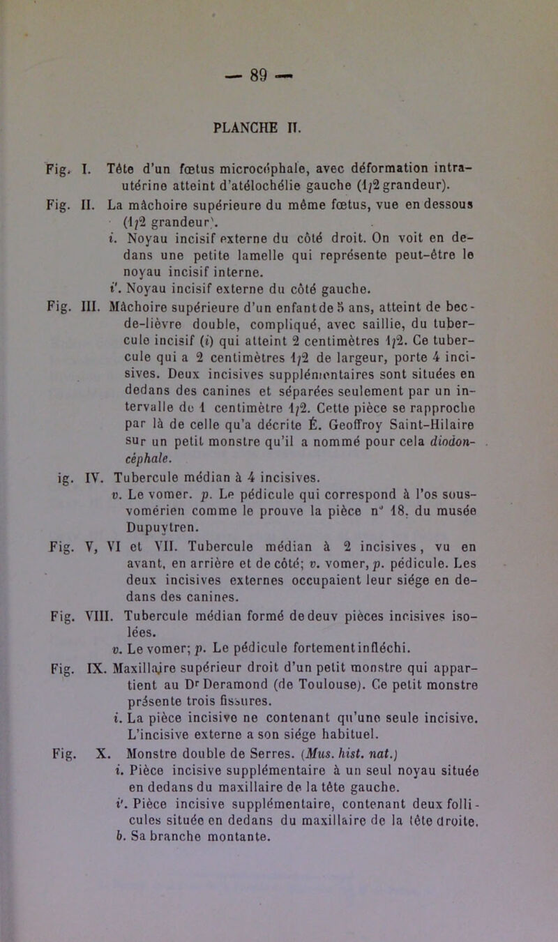 — 89 PLANCHE II. Fig. I. Tête d’un fœtus microcéphale, avec déformation intra- utérine atteint d’atélochélie gauche (1/2 grandeur). Fig. II. La mâchoire supérieure du même fœtus, vue en dessous (1/2 grandeur'. t. Noyau incisif externe du côté droit. On voit en de- dans une petite lamelle qui représente peut-être le noyau incisif interne, t'. Noyau incisif externe du côté gauche. Fig. III. Mâchoire supérieure d’un enfantde 8 ans, atteint de bec- de-lièvre double, compliqué, avec saillie, du tuber- cule incisif (i) qui atteint 2 centimètres 1/2. Ce tuber- cule qui a 2 centimètres 1/2 de largeur, porte 4 inci- sives. Deux incisives supplémentaires sont situées en dedans des canines et séparées seulement par un in- tervalle de 1 centimètre 1/2. Cette pièce se rapproche par là de celle qu’a décrite É. Geoffroy Saint-Hilaire sur un petit monstre qu’il a nommé pour cela diodon- céphale. ig. IV. Tubercule médian à 4 incisives. V. Le vomer. p. Le pédicule qui correspond à l’os sous- vomérieii comme le prouve la pièce n'' 18, du musée Dupuytren. Fig. V, VI et VIL Tubercule médian à 2 incisives, vu en avant, en arrière et de côté; v. vomer, p. pédicule. Les deux incisives externes occupaient leur siège en de- dans des canines. Fig. VIII. Tubercule médian formé dedeuv pièces incisives iso- lées. V. Le vomer; p. Le pédicule fortementinfléchi. Fig. IX. Maxillajre supérieur droit d’un petit monstre qui appar- tient au DfDeramond (de Toulouse). Ce petit monstre présente trois fissures. i. La pièce incisive ne contenant qu’une seule incisive. L’incisive externe a son siège habituel. Fig. X. Monstre double de Serres. (Mus. hist. nat.) i. Pièce incisive supplémentaire à un seul noyau située en dedans du maxillaire de la tête gauche, t'. Pièce incisive supplémentaire, contenant deux folli- cules située en dedans du maxillaire de la (ête droite. b. Sa branche montante.