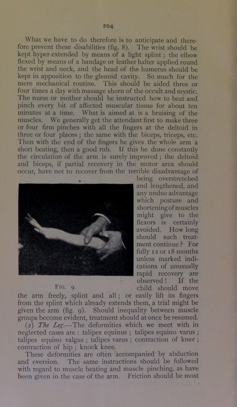 Whai we have to do therefore is to anticipate and there- fore prevent these disabilities (fig. 8). 'I’he wrist should be kept hyper-extended by means of a light splint; the elbow flexed by means of a bandage or leather halter applied round the wrist and neck, and the head of the humerus should be kept in apposition to the glenoid cavity. So much for the mere mechanical routine. This should be aided three or four times a day with massage shorn of the occult and mystic, 'fhe nurse or mother should be instructed how to beat and pinch every bit of affected muscular tissue for about ten minutes at a time. What is aimed at is a bruising of the muscles. We generally get the attendant first to make three or four firm pinches with all the fingers at the deltoid in three or four places ; the same with the biceps, triceps, etc. 'I’hen with the end of the fingers he gives the whole arm a short beating, then a good rub. If this be done constantly the circulation of the arm is surely improved ; the deltoid and biceps, if partial recovery in the motor area should occur, have not to recover from the terrible disadvantage of being overstretched and lengthened, and any undue advantage which posture and shorteningof muscles might give to the flexors is certainly avoided. How long should such treat- ment continue ? For fully 12 or 18 months unless marked indi- cations of unusually rapid recovery are observed ! If the Fig- 9- child should move the arm freely, splint and all; or easily lift its fingers from the splint which already extends them, a trial might be given the arm (fig. 9). Should inequality between muscle groups become evident, treatment should at once be resumed. (2) The Le^.—The deformities which we meet with in neglected cases are : talipes equinus ; talipes equino varus ; talipes equino valgus ; talipes varus ; contraction of knee ; contraction of hip ; knock knee. These deformities are often accompanied by abduction and eversion. The same instructions should be followed with regard to muscle beating and muscle pinching, as have been given in the case of the arm. Friction should be most