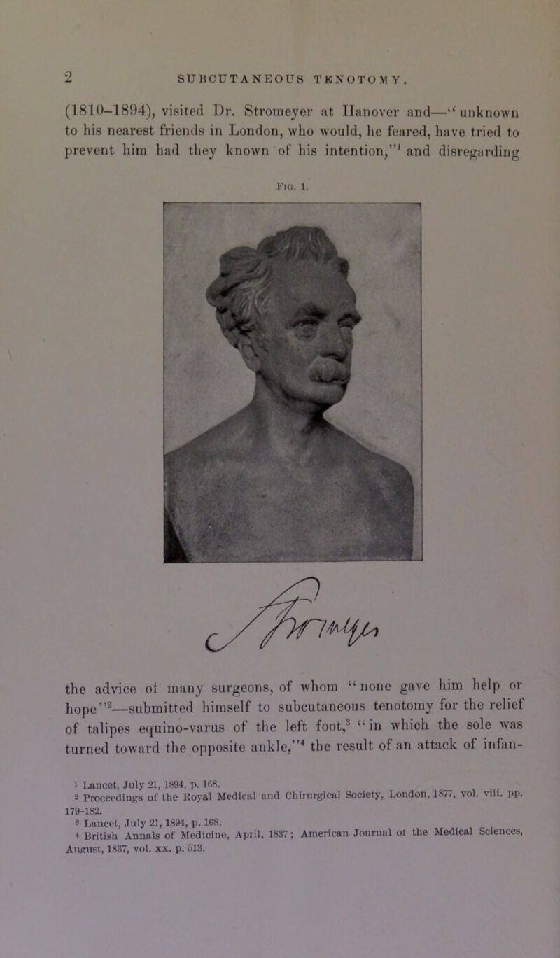 o (1810-1894), visited Dr. Stroineyer at Hanover and—‘‘unknown to his nearest friends in London, who would, he feared, have tried to prevent him had tliey known of liis intention,”* and disregarding Fia. 1. the advice ot many surgeons, of whom “ none gave him help or hope”2—submitted himself to subcutaneous tenotomy for the relief of talipes equino-varus of the left foot,® “ in which the sole was turned tow'ard the opposite ankle,”'* the result of an attack of infan- * Lancet, July 21, 1894, p. 168. 2 Proceedings of the Koyal Medical and Chiiurgical Society, London, 1877, vol. vili. pp. 179-182. » Lancet, July 21,1894, p. 168. * British Annals of Medicine, April, 1837; American Jounial ot the Medical Sciences,