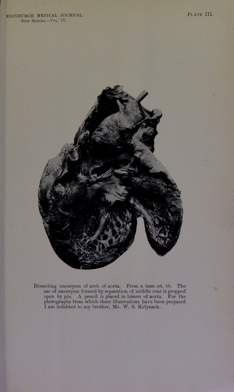New Seuies.—Vol. IV. Plate III. Di.ssecting aneurysm of arch of aorta. From a man tet. 40. The sac of aneurysm formed by separation of middle coat is propped open by pin. A pencil is placed in lumen of aorta. For the photographs from which these illustrations have been prepared I am indebted to my brother, Mr. W. S. Kelynack.