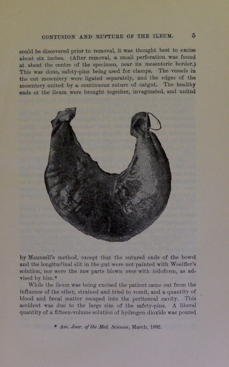 could be discovered prior to removal, it was thought best to excise about six inches. (After removal, a small perforation was found at about the centre of the specimen, near its mesenteric border.) This was done, safety-pins being used for clamps. The vessels in the cut mesentery were ligated separately, and the edges of the mesentery united by a continuous suture of catgut. The healthy ends ol the ileum were brought together, invaginated, and united by Maunsell’s method, except that the sutured ends of the bowel and the longitudinal slit in the gut were not painted with Woelfler’s solution, nor were the raw parts blown over with iodoform, as ad- vised by him.* While the ileum was being excised the patient came out from the influence of the ether, strained and tried to vomit, and a quantity of blood and fjccal matter escaped into the peritoneal cavity. This accident was due to the large size of the safety-pins. A liberal quantity of a fifteen-volume solution of hydrogen dioxide was poured ♦ Am. Jour, of the Med. Sciences, March, 1892.