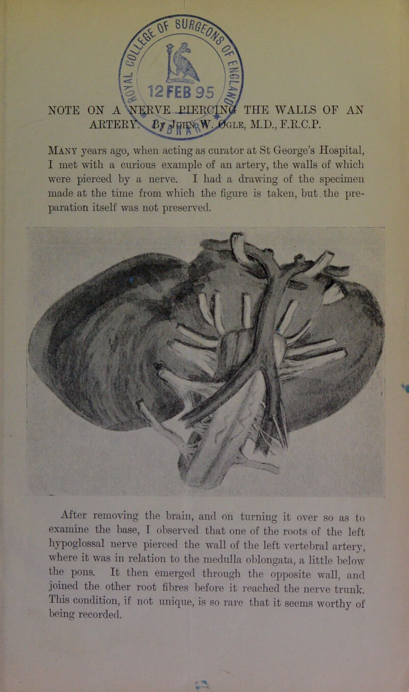 T NOTE ON A ARTER THE WALLS OF AN M.D., F.R.C.P. Many years ago, when acting as curator at St George’s Hospital, I met with a curious example of an artery, the walls of which were pierced by a nerve. I had a drawing of the specimen made at the time from which the figure is taken, but the pre- paration itself was not preserved. After removing the brain, and on turning it over so as to examine the base, I observed that one of the roots of the left hypoglossal nerve pierced the wall of tlie left vertebral artery, where it was in relation to tlie medulla ol)longata, a little below tlie pons. It then emerged through the opposite wall, and joined the other root fibres before it reached the nerve trunk. This condition, if not unique, is so rare that it seems worthy of being recorded.