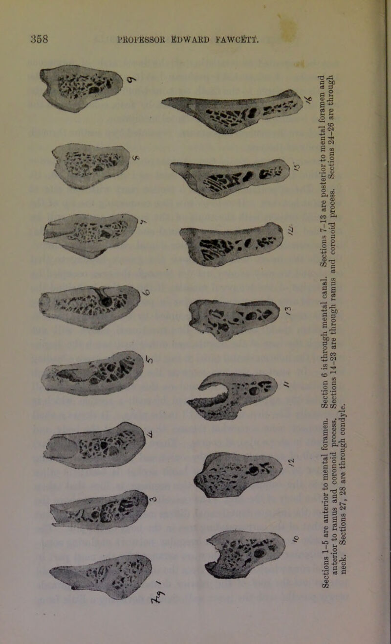 Sections 1-5 are anterior to mental foramen. Section 6 is through mental canal. Sections 7-13 are posterior to mental foramen and anterior to ramus and coronoid process. Sections 14-23 are through ramus and corouoid process. Sections 24-26 are through neck. Sections 27, 28 are through condyle.