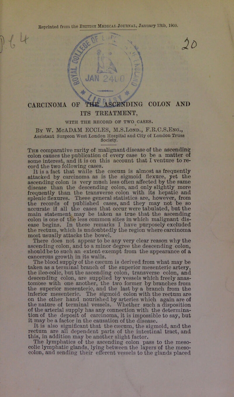 Reprinted from the BniTisn Medical Jotoval, January 13th, 1900. CARCINOMA OF ASCENDING COLON AND ITS TREATMENT, WITH THE RECORD OF TWO CASES. By W. McADAM ECCLES, M.S.Lond,, F.R.C.S.Eng., Assistant Surgeon West London Hospital and City of London Truss Society. The comparative rarity of malignant disease of the ascending colon causes the publication of every case to be a matter of some interest, and it is on this account that I venture to re- cord the two following cases. It is a fact that while the ciecum is almost as frequently attacked by carcinoma as is the sigmoid flexure, yet the ascending colon is very much less often affected by the same disease than the descending colon, and only slightly more frequently than the transverse colon with its hepatic and splenic flexures. These general statistics are, however, from the records of published cases, and they may not be so accurate if all the cases that occur were tabulated, but the main statement^ may be taken as true that the ascending colon is one of the less common sites in which malignant dis- ease begins. In these remarks I have purposely excluded the rectum, which is undoubtedly the region where carcinoma most usually attacks the bowel. There does not appear to be any very clear reason why the ascending colon, and to a minor degree the descending colon, should be to such an extent exempt from the appearance of a cancerous growth in its walls. The blood supply of the caecum is derived from what may be taken as a terminal branch of the superior mesenteric artery, the ileo-coJic, but the ascending colon, transverse colon, and descending colon, are supplied by vessels which freely anas- tomose with one another, the two former by branches from the superior mesenteric, and the last by a branch from the inferior mesenteric. The sigmoid colon with the rectum are on the other hand nourished by arteries which again are of the nature of terminal vessels. Whether such a disposition of the arterial supply has any connection with the determina- tion of the deposit of carcinoma, it is impossible to say, but it may be a factor in the causation of the disease. It is also signiflcant that the ciecum, the sigmoid, and the rectum are all dependent parts of the intestinal tract, and this, in addition may be another slight factor. The lymphatics of the ascending colon pass to the meso- colic lymphatic glands, lying between the layers of the meso- colon, and sending their efferent vessels to the glands placed