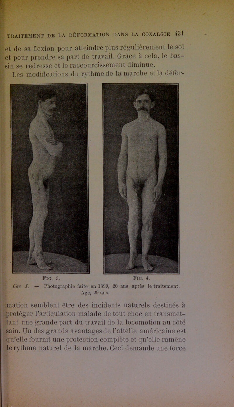 et de sa flexion pour atteindre pins régulièrement le sol et pour prendre sa part de travail. Grâce à cela, le bas- sin se redresse et le raccourcissement diminue. Les modificafions du rythme de la marche et la défor- Fig. 3. Fig. 4. Cax I. — Photographie faite oq 20 ans après le traitement. Age, 29 ans. mation semblent être des incidents naturels destinés à protéger rarticulation malade tle tout choc en transmet- tant une grande part du ti-avail de la locomotion au côté sain. Un des grands avantages de l’attelle américaine est iiu’elle Iburnit une protection complète et ({u’elle ramène le rythme naturel de la marche. Ceci demande une force (