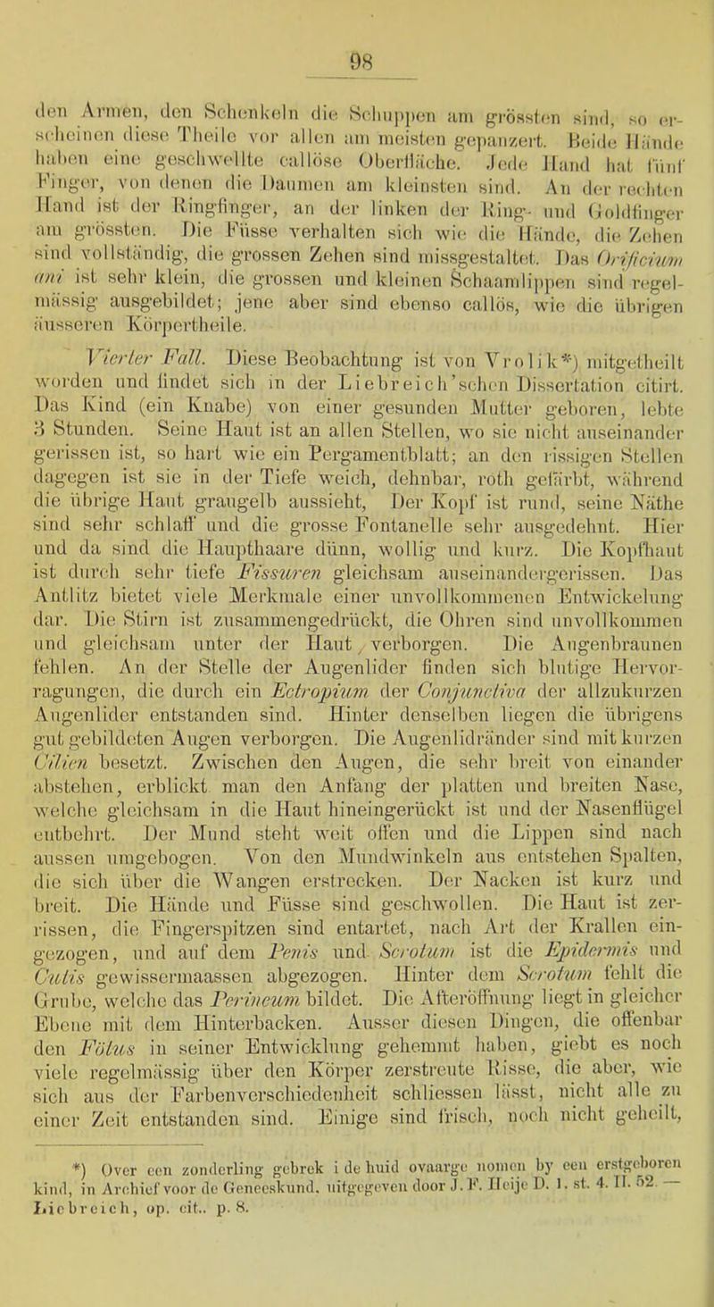 tloii Annen, den Sclniiikeln die Selnipjien am gi-össieii sind, so (‘p- selieinen diosii Tlieilc vor allen am meistern gepanzert. Heide lläml»! Iiabon eine geschwellte callöso Oheriläehe.' .leihe Jland hat tiinr Finger, von denen die Daumen am kleinsten sind. An der rechten Hand ist der Ilingtinger, an der linken der Ring- und (Jiddiinger am grössten. Die Fiisse verhalten sich wii; die Hände, die Zehen sind vollständig, die grossen Zehen sind missgestaltet. Das (hificiuvi (Uli ist sehr klein, die grossen und kleinen Bchaamlippen sind regel- ma’ssig ausgebildet; jene aber sind ebenso callös, wie die übrigen äusseren Körjiertheile. Yierler Fall. Diese Beobachtung ist von Vrolik'^') mitgetheilt woi’den und lindet sich in der L i ehr ei c h'schon Dissertation citirt. Das Kind (ein Knabe) von einer gesunden Mutter geboren, lebte H Stunden. Seine Haut ist an allen Stellen, wo sie nicht auseinander gerissen ist, so hart wie ein Perganientblatt; an den rissigen Stellen dagegen ist sie in der Tiefe weich, dehnbar, roth gelärbt, während die übrige Kant graugelb aussieht. Der Koid ist rund, seine Käthe sind sehr schlaff und die grosse Fontanelle sehr ausgedehnt. Hier und da sind die Haupthaare dünn, wollig und kurz. Die Kopfhaut ist durch sehr tiefe Fissure?i gleichsam auseinandergerissen. Das Antlitz bietet viele Merkmale einer unvollkommenen Entwickelung dar. Die Stirn ist zusammengedrückt, die Ohren sind unvollkommen und gleichsam unter der Haut verborgen. Die Augenbraunen fehlen. An der Stelle der Augenlider finden sich blutige Hervor- ragungen, die durch ein Ectropium, der Gonjnnctiva der allzukurzen Augenlider entstanden sind. Hinter denselben liegen die übrigens gut gebildeten Augen verborgen. Die Augenlidränder sind mit kurzen Cilien besetzt. Zwischen den Augen, die sehr breit von einander abstehen, erblickt man den Anfang der }>latten und breiten Käse, welche gleichsam in die Haut hineingerückt ist und der Nasenflügel entbehrt. Der Mund steht weit ollen und die Lippen sind nach aussen umgebogen. A^on den Alundwinkeln aus entstehen Spalten, die sich über die Wangen erstrecken. Der Kacken ist kurz und breit. Die Hände und Füsse sind geschwollen. Die Haut ist zer- rissen, die Fingerspitzen sind entartet, nach Ai’t der Krallen ein- gezogen, und auf dem Fenis und Scrolum ist die Epidermis und C'iiiis gewisserniaassen abgezogen. Hinter dem Scrofum fehlt die Orubo, welche das Ferineum. bildet. Die AfterÖlfnnng liegt in gleicher Ebene mit dem Hinterbacken. Ausser diesen Dingen, die offenbar den Fötus in seiner Entwicklung gehemmt haben, giebt es noch viele regelmässig über den Körper zerstreute Risse, die aber, wie sich aus der Farbenverschiedenheit schliessen lässt, nicht alle zu einer Zeit entstanden sind. Einige sind frisch, noch nicht geheilt. *) Over cen zondcrling gebrek i de buid ovaavge nonien by eeu cr.stgohorcn kind, in Arnhief voor de Gonecsknnd, uitgegeven düor J.K Ileije D. 1. sl. 4. II. !>2. I.icbveich, ap. cit.. p. 8.