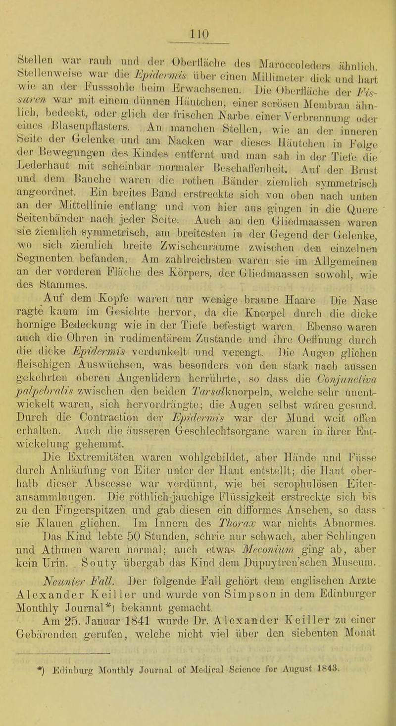 btellen war rauh mid dur Ohci-llholiR dos Marocoolodors ähnlich, htcdlomvoise war dio F.pidrnms über einen Millinielor dick und liart wie an der husssohh; heim hh'wachsenen. Die OhorlläclK! dei- Fis- mrm war mit einem dünnen Häutchen, einer serösen Membran ähn- lich, bedeckt, oder gdicli der Irischen iNarbe einer Verbi-onnung oder eines Dlaseni.Hasters. An manchen Btollen, wie an der inneren Seite der Gelenke nnd^ am Nacken war dieses Häntchon in Folge der EeMmg-nnpn des Kindes entiernt und man sah in der Tiele die Lederhant mit scheinbar normaler EeschaHenlieit. Auf der Ernst und dem Eanche waren die rothen Eänder ziemlich symmetrisch angeoidnet. Ein breites Eand erstreckte sich Amn oben nach unten an der Alittellinie entlang und Amn hier ans gingen in die Quere Seitenbändel nach jeder Seite. Auch an den Gliedniaassen Avaron sie ziemlich symmetrisch, am breitesten in der Gegend der Gelenke, AN 0 Sich ziemlich breite i^Avischenräiime zwischen den einzelnen Segmenten befanden. Am zahlreichsten Av^aren sie im Allgemeinen an der vorderen Fläche des Körpers, der Gliedniaassen sowohl, aauc des Stammes. Auf dem Kopfe waren nur wenige braune Haare Die Nase ragte kaum im Gesichte hervor, da die Knorpel durch die dicke hornige Eedeckiing wie in der Tiefe befestigt waren. Ebenso waren auch die Ohren in rudimentärem Zustande und ihre Oeffnung durch die dicke E'indermis verdunkelt und verengt. Die Augen glichen fleischigen Auswiichsen, was besonders von den stark nach aussen gekehrten oberen Augenlidern herriilirte, so dass die Conjimcliva pcdpehralis zwu’schen den beiden Tar.sfl'/knorpeln, welche sehr iinent- Avickelt waren, sich hervordrängte; die Augen selbst Awären gesund. Durch die Contraction der Epidermis war der Mund Aveit olien erhalten. Auch die äusseren Geschlechtsorgane Avaren in ihrer Eiit- Avickelung gehemmt. Die Extremitäten Avaren wohlgcbildet, aber Hände und Fiisse durch Anhäufung von Eiter unter der Haut entstellt; die Haut ober- halb dieser Abscesse Avar verdünnt, wie bei scrophnlösen Eitcr- ansamnilungen. Die röthlich-jaiichige Flüssigkeit erstreckte sich bis zu den Fingerspitzen und gab diesen ein difibrmes Ansehen, so dass sie Klauen glichen. Im Innern des Thorax Avar nichts Abnormes. Das Kind lebte 50 Stunden, schrie nur schwach, aber Schlingon und Athmen waren normal; auch etwas Meconium ging ab, aber kein Urin. Souty übergab das Kind dem Dupnytren’schen j\lusenm. Neunter Fall. Der folgende Fall gehört dem englischen Arzte Alexander Keil 1er und wurde von Simpson in dem Edinburger Monthly JournaU') bekannt gemacht. Am 25. Januar 1841 Avurde Dr. Alexander Keil 1er zu einer Gebärenden gerufen, welche nicht viel über den siebenten Monat ’) E(liiil)urg Montlily Journal of Medical Science Ibr August 1843.