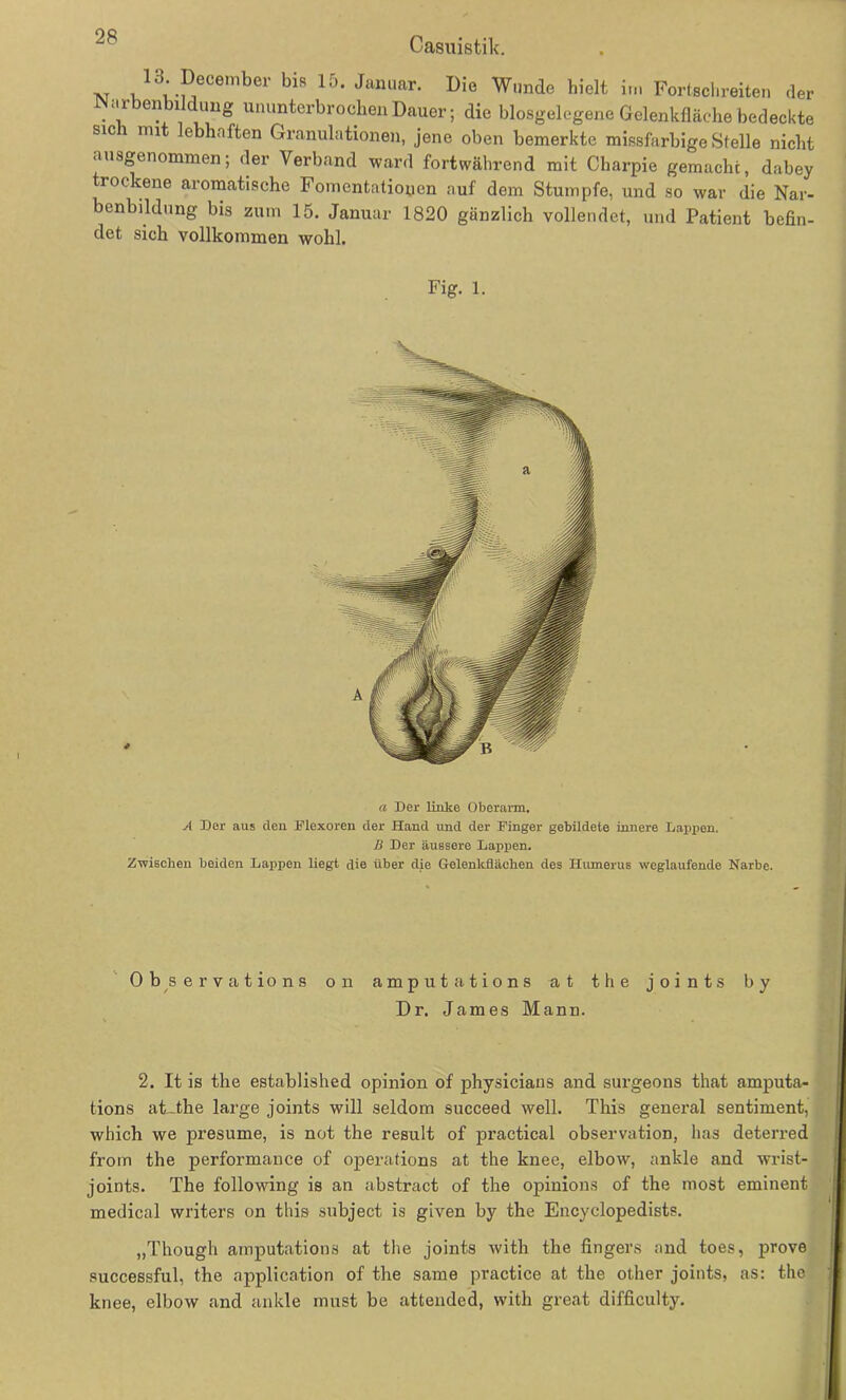 13. December bis 15. Januar. Die Wunde hielt im Fortschreiten der JNarbenbildung ununterbrochen Dauer; die blosgelegene Gelenkfläche bedeckte sici mi ebhaften Granulationen, jene oben bemerkte missfarbige Stelle nicht ausgenommen; der Verband ward fortwährend mit Charpie gemacht, dabey trockene aromatische Fomentatioyen auf dem Stumpfe, und so war die Nar- benbildung bis zum 15. Januar 1820 gänzlich vollendet, und Patient befin- det sich vollkommen wohl. Fig. l. a Der linke Oberarm. A Der aus tlen Flexoren der Hand und der Finger gebildete innere Lappen. B Der äussere Lappen. Zwischen beiden Lappen liegt die über die Gelenkflächen des Humerus weglaufende Narbe. Observations on amputations a t the joints by Dr. James Mann. 2. It is the established opinion of physicians and surgeons that amputa- tions at_the large joints will seldom succeed well. This general sentiment, which we presume, is not the result of practical observation, 1ms deterred froin the performance of operations at the knee, elbow, ankle and wrist- joints. The following is an abstract of the opinions of the most eminent medical writers on this subject is given by the Encyclopedists. „Thougli amputations at the joints with the fingers and toes, prove successful, the application of the sarae practice at the other joints, as: the knee, elbow and ankle must be attendcd, with great difficulty.