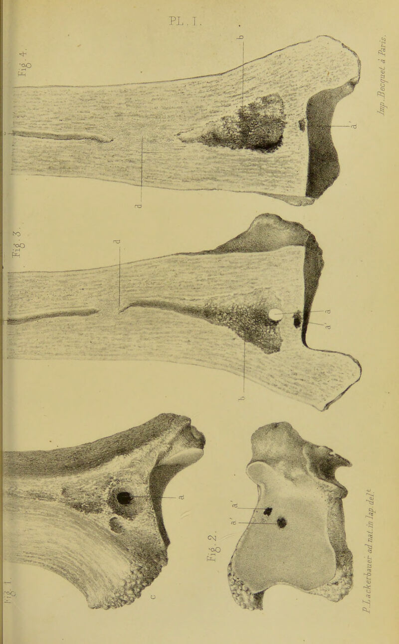 P.lackerlauer adnat.in Jap. delt