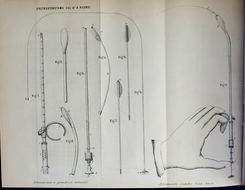 URETROSTENOTOMO DEL D'A.RICORDI ,/t/r/tnw/do <( (/rn/u/c:ui nidNr<t/c ,/s / /-mn e/r / n rn/o/fo d rt// /rnzn