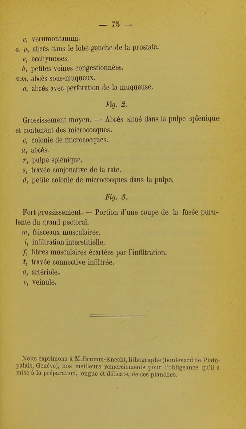 v, verumontanum. a, p, abcès dans le lobe gauche de la prostate. e, ecchymoses. h, petites veines congestionnées. a.m, abcès sous-muqueux. 0, abcès avec perforation de la muqueuse. Fig. 2. Grossissement moyen. — Abcès situé dans la pulpe splénique- et contenant des micrococques. c, colonie de micrococques. a, abcès. r, pulpe splénique. s, travée conjonctive de la rate. d, petite colonie de micrococques dans la pulpe. Fig. 3. Fort grossissement. — Portion d’une coupe de la fusée puru- lente du grand pectoral. m, faisceaux musculaires. 1, infiltration interstitielle. /', fibres musculaires écartées par l’infiltration. t, travée connective infiltrée. a, artériole. v, veinule. Nous exprimons à M. Brumm-Knecht, lithographe (boulevard de Plain- palais, Genève), nos meilleurs remerciements pour l’obligeance qu’il a mise à la préparation, longue et délicate, de ces planches.