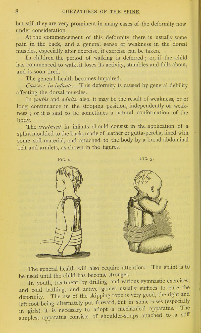 but still they are very prominent in many cases of the deformity now under consideration. At the commencement of this deformity there is usually some pain in the back, and a general sense of weakness in the dorsal muscles, especially after exercise, if exercise can be taken. In children the period of walking is deferred ; or, if the child has commenced to walk, it loses its activity, stumbles and falls about, and is soon tired. The general health becomes impaired. Causes: in infants.—This deformity is caused by general debility affecting the dorsal muscles. In youths and adults, also, it may be the result of weakness, or of long continuance in the stooping position, independently of weak- ness ; or it is said to be sometimes a natural conformation of the body. The treatmetit in infants should consist in the application of a splint moulded to the back, made of leather or gutta-percha, lined with some soft material, and attached to the body by a broad abdominal belt and armlets, as shown in the figures. The general health will also require attention. The splint is to be used until the child has become stronger. In youth, treatment by drilling and various gymnastic exercises, and cold bathing, and active games usually suffices to cure the deformity. The use of the skipping-rope is very good, the right and left foot being alternately put forward, but in some cases (especially in girls) it is necessary to adopt a mechanical apparatus. The simplest apparatus consists of shoulder-straps attached to a stiff Fig. 2, Fig. 3