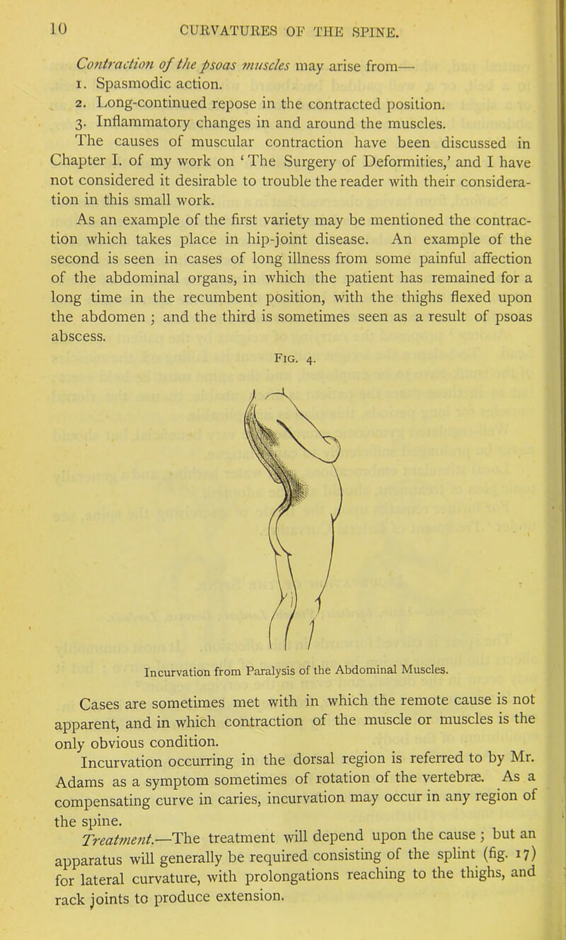 Contractio7i of the psoas inusdes may arise from— 1. Spasmodic action. 2. Long-continued repose in the contracted position. 3. Inflammatory changes in and around the muscles. The causes of muscular contraction have been discussed in Chapter I. of my work on ‘ The Surgery of Deformities,’ and I have not considered it desirable to trouble the reader with their considera- tion in this small work. As an example of the first variety may be mentioned the contrac- tion which takes place in hip-joint disease. An example of the second is seen in cases of long illness from some painful affection of the abdominal organs, in which the patient has remained for a long time in the recumbent position, with the thighs flexed upon the abdomen ; and the third is sometimes seen as a result of psoas abscess. Fig. 4. Incurvation from Paralysis of the Abdominal Muscles. Cases are sometimes met with in which the remote cause is not apparent, and in which contraction of the muscle or muscles is the only obvious condition. Incurvation occurring in the dorsal region is referred to by Mr. Adams as a symptom sometimes of rotation of the vertebrae. As a compensating curve in caries, incurvation may occur in any region of the spine. Treatnmit.—i:\\t treatment will depend upon the cause ; but an apparatus will generally be required consisting of the splint (fig. 17) for lateral curvature, with prolongations reaching to the thighs, and rack joints to produce extension.