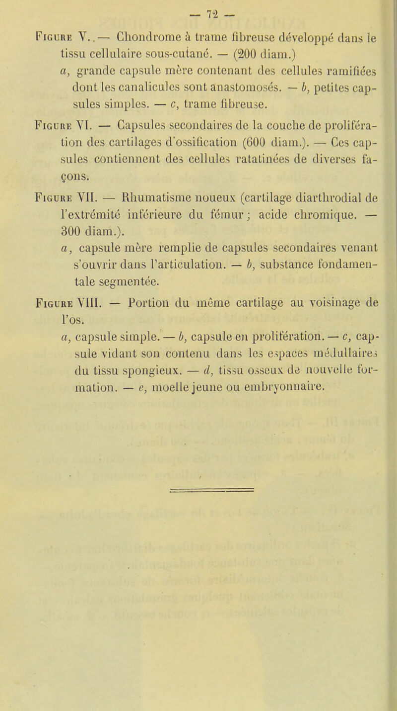 n — Figure V..— Chondrome à trame fibreuse développé dans le tissu cellulaire sous-cutané. — (200 diam.) a, grande capsule mère contenant des cellules ramifiées dont les canaliculcs sont anastomosés. — b, petites cap- sules simples. — c, trame fibreuse. Figure YI. — Capsules secondaires de la couche de proliféra- tion des cartilages d’ossification (600 diam.). — Ces cap- sules contiennent des cellules ratatinées de diverses fa- çons. Figure YII. — Rhumatisme noueux (cartilage diarthrodial de l’extrémité inférieure du fémur ; acide chromique. — 300 diam.). a, capsule mère remplie de capsules secondaires venant s’ouvrir dans l’articulation. — b, substance fondamen- tale segmentée. Figure YIII. — Portion du même cartilage au voisinage de l’os. a, capsule simple. — b, capsule en prolifération. — c, cap- sule vidant son contenu dans les espaces médullaires du tissu spongieux. — d, tissu osseux de nouvelle for- mation. — e, moelle jeune ou embryonnaire.