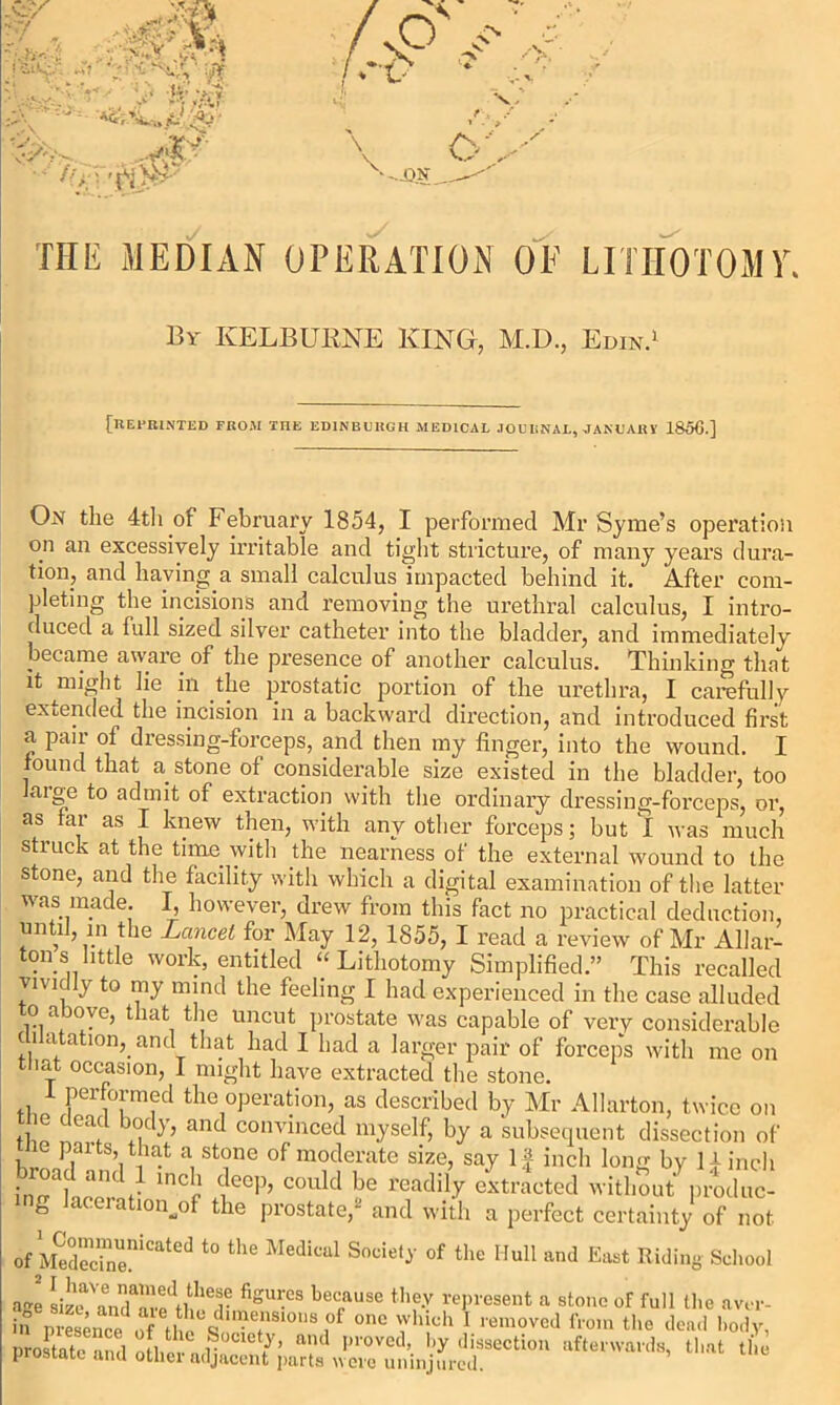 THE MEDIAN OPERATION OF LITHOTOMY. By KELBURNE KING, M.D., Edin.1 [REPRINTED FROM THE EDINBURGH MEDICAL JOURNAL, -JANUARY 1850.] On the 4th of February 1854, I performed Mr Syme’s operation on an excessively irritable and tight stricture, of many years dura- tion, and haying a small calculus impacted behind it. After com- pleting the incisions and removing the urethral calculus, I intro- duced a full sized silver catheter into the bladder, and immediately became aware of the presence of another calculus. Thinking that it ^miglit lie in the prostatic portion of the urethra, I carefully extended the incision in a backward direction, and introduced first a pair of dressing-forceps, and then my finger, into the wound. I found that a stone of considerable size existed in the bladder, too large to admit of extraction with the ordinary dressing-forceps, or, as far as I knew then, with any other forceps; but I was much stiuck at the time with the nearness of the external wound to the stone, and the facility with which a digital examination of the latter was made. I, however, drew from this fact no practical deduction, until, in the Lancet for May 12, 1855, I read a review of Mr Allar- tons little work, entitled “Lithotomy Simplified.” This recalled vividly to my mind the feeling I had experienced in the case alluded to above, that the uncut prostate was capable of very considerable c natation,. and that had I had a larger pair of forceps with me on that occasion, I might have extracted the stone. 1 Performed the operation, as described by Mr Allarton, twice on G C<?a' ,, L anc^ convinced myself, by a subsequent dissection of me parts that a stone of moderate size, say If inch long by Hindi “ “d,' >”<=J top, could be readily extracted without pitduc- g aceration.of the prostate,2 and with a perfect certainty of not ofSrCatd t0 the Medical Souie^' of the Hul1 and Ea«t Riding School age Lm Vandam.BdtHhea- figU™S bec,ause the-v ^present a stone of full the anr- ifpSnceof Ib%dn™1S10118 ,of 0I1C which I removed from the dead body, prostate •uid oMin. n ^> aiul piovred, by dissection afterwards, that the prostate and other adjacent parts were uninjured.
