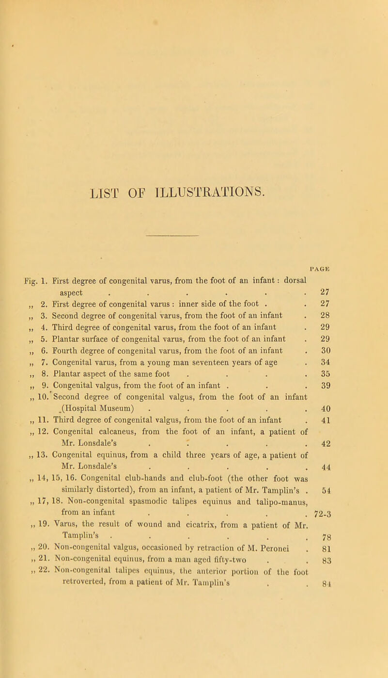 LIST OF ILLUSTRATIONS. PAGE Fig. 1. First degree of congenital varus, from the foot of an infant: dorsal aspect . . . . . .27 ,, 2. First degree of congenital varus : inner side of the foot . . 27 „ 3. Second degree of congenital varus, from the foot of an infant . 28 „ 4. Third degree of congenital varus, from the foot of an infant . 29 „ 5. Plantar surface of congenital varus, from the foot of an infant . 29 „ 6. Fourth degree of congenital varus, from the foot of an infant . 30 „ 7. Congenital varus, from a young man seventeen years of age . 34 ,, 8. Plantar aspect of the same foot . . . .35 „ 9. Congenital valgus, from the foot of an infant . . .39 „ 10. Second degree of congenital valgus, from the foot of an infant ,(Hospital Museum) . . . . .40 „ 11. Third degree of congenital valgus, from the foot of an infant . 41 „ 12. Congenital calcaneus, from the foot of an infant, a patient of Mr. Lonsdale’s . . . .42 „ 13. Congenital equinus, from a child three years of age, a patient of Mr. Lonsdale’s . . . . .44 „ 14, 15, 16. Congenital club-hands and club-foot (the other foot was similarly distorted), from an infant, a patient of Mr. Tamplin’s . 54 „ 17, 18. Non-congenitnl spasmodic talipes equinus and talipo-manus, from an infant • • . . . 72-3 „ 19. Varus, the result of wound and cicatrix, from a patient of Mr. Tamplin’s . . . . . .78 „ 20. Non-congenital valgus, occasioned by retraction of M. Peronei . 81 ,, 21. Non-congenital equinus, from a man aged fifty-two . , 83 „ 22. Non-congenital talipes equinus, the anterior portion of the foot retroverted, from a patient of Mr. Tainplin’s . . 84