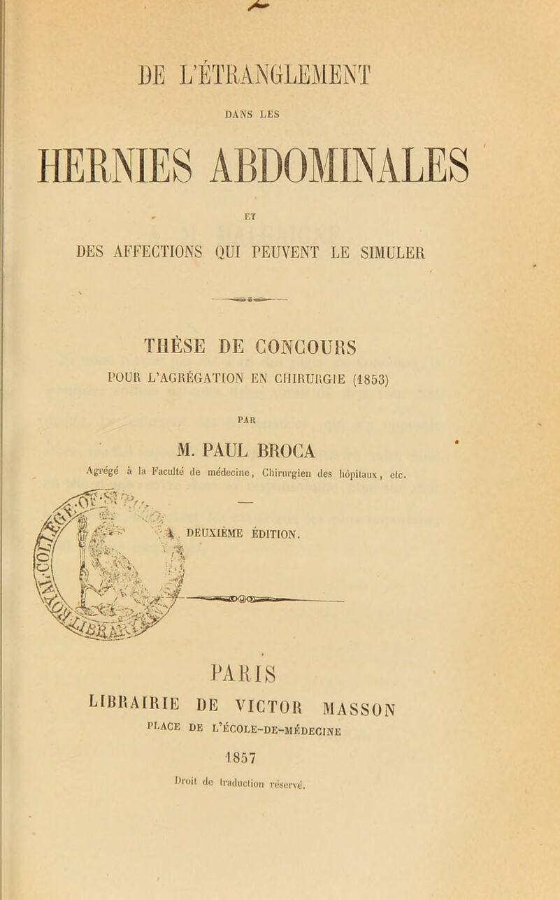 DANS LES - ET DES AFFECTIONS QUI PEUVENT LE SIMULER THÈSE DE CONCOUnS POUR L’AGRÉGATION EN CHIRURGIE (1853) PAIt M. PAUL BROCA Agrège à la Eacullè de médecine, Chirurgien des luipilaux, etc. librairie de VICTOR MASSON PLACE DE L’ÉCOLE-DE-MÉDECINE 1857 Droit de Iraduclioii réservé.