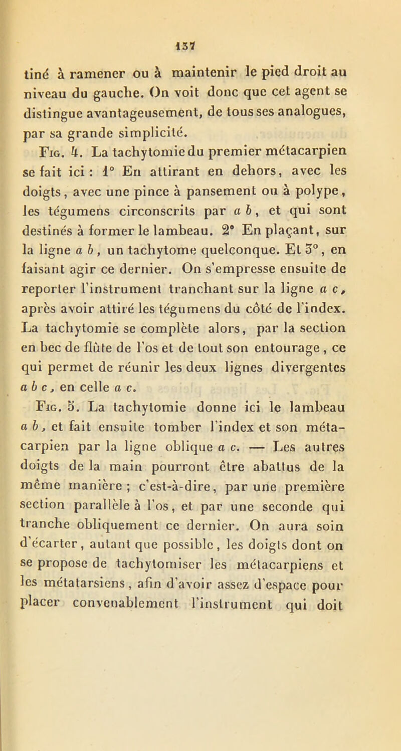 tiné à ramener ou à maintenir le pied droit au niveau du gauche. On voit donc que cet agent se distingue avantageusement, de tousses analogues, par sa grande simplicité. Fig. La tachytomie du premier métacarpien se fait ici: 1° En attirant en dehors, avec les doigts, avec une pince à pansement ou à polype, les tégumens circonscrits par a b, et qui sont destinés à former le lambeau. 2® En plaçant, sur la ligne a b , un tacliytome quelconque. El 3°, en faisant agir ce dernier. On s’empresse ensuite de reporter l’instrument tranchant sur la ligne a c, après avoir attiré les tégumens du côté de l’index. La tachytomie se complète alors, par la section en bec de flûte de l’os et de tout son entourage , ce qui permet de réunir les deux lignes divergentes abc, en celle a c. Fig. 5. La tachytomie donne ici le lambeau a b, et fait ensuite tomber l’index et son méta- carpien par la ligne oblique a c. — Les autres doigts de la main pourront être abattus de la même manière; c’est-à-dire, par une première section parallèle à l'os, et par une seconde qui tranche obliquement ce dernier. On aura soin d’écarter, autant que possible, les doigts dont on se propose de tachytomiser les métacarpiens et les métatarsiens, afin d’avoir assez d’espace pour placer convenablement l’instrument qui doit