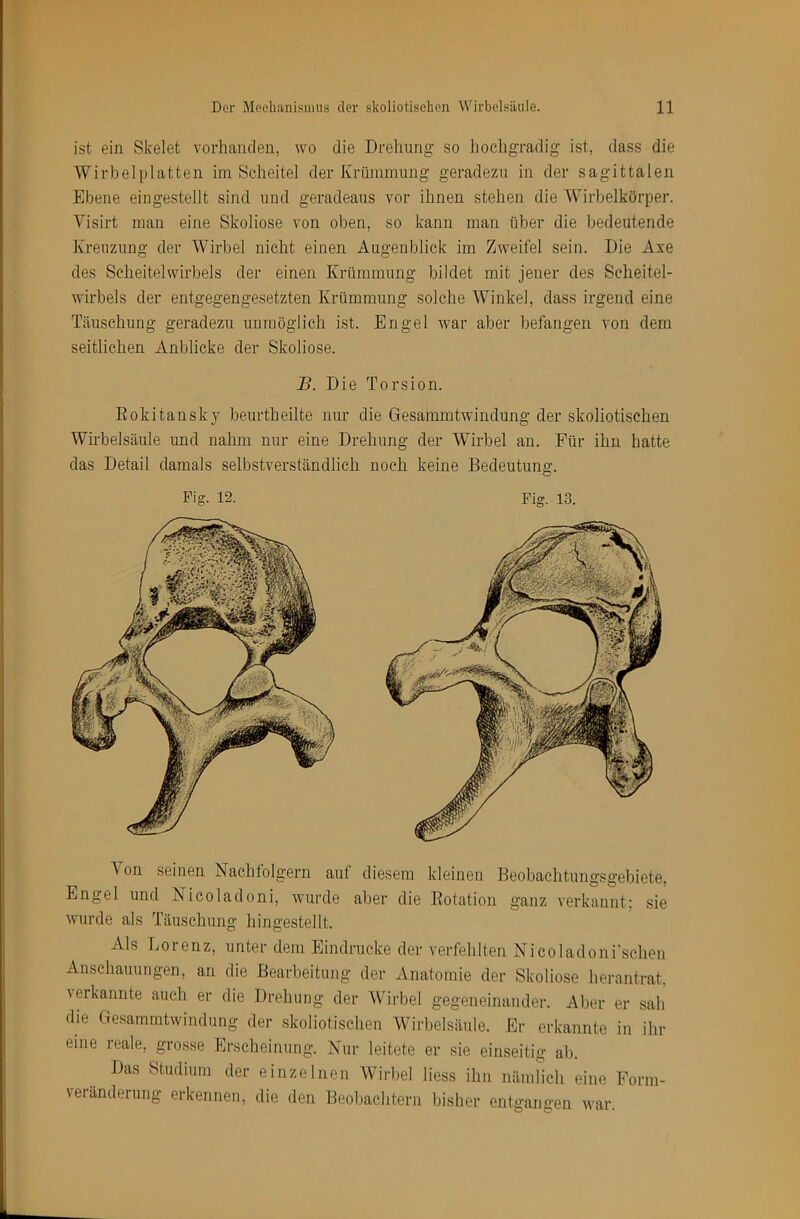 ist ein Skelet vorhanden, wo die Drehung so hochgradig ist, dass die Wirbelplatten im Scheitel der Krümmung geradezu in der sagittalen Ebene eingestellt sind und geradeaus vor ihnen stehen die Wirbelkörper. Visirt man eine Skoliose von oben, so kann man über die bedeutende Kreuzung der Wirbel nicht einen Augenblick im Zweifel sein. Die Axe des Scheitelwirbels der einen Krümmung bildet mit jener des Scheitel- wirbels der entgegengesetzten Krümmung solche Winkel, dass irgend eine Täuschung geradezu unmöglich ist. Engel war aber befangen von dem seitlichen Anblicke der Skoliose. B. Die Torsion. Eokitansky beurtheilte nur die Gesammtwindung der skoliotisehen Wirbelsäule und nahm nur eine Drehung der Wirbel an. Für ihn hatte das Detail damals selbstverständlich noch keine Bedeutung. Fig. 12. Fig. 13. Von seinen Nachtolgern aut diesem kleinen Beobachtungsgebiete, Engel und Nicoladoni, wurde aber die Eotation ganz verkannt: sie wurde als Täuschung hingestellt. Als Lorenz, unter dem Eindrücke der verfehlten Nicoladonrschen Anschauungen, an die Bearbeitung der Anatomie der Skoliose herantrat, verkannte auch er die Drehung der Wirbel gegeneinander. Aber er sah die Gesammtwindung der skoliotisehen Wirbelsäule. Er erkannte in ihr eine reale, grosse Erscheinung. Nur leitete er sie einseitig ab. Das Studium der einzelnen AVirbel Hess ihn nämlich eine Form- veränderung erkennen, die den Beobachtern bisher entgangen war.