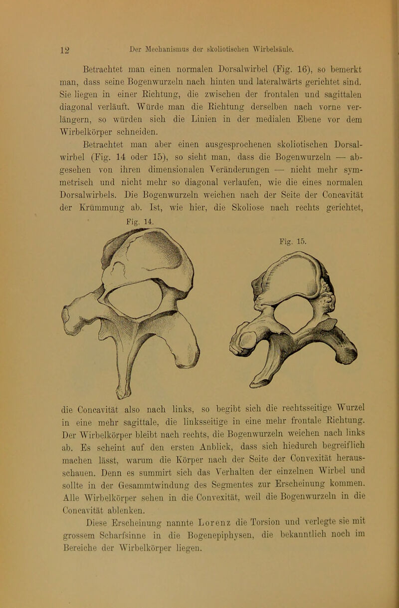 Betrachtet man einen normalen Dorsalwirbel (Fig. 16), so bemerkt man, dass seine Bogenwurzeln nach hinten und lateralwärts gerichtet sind. Sie liegen in einer Richtung, die zwischen der frontalen und sagittaleri diagonal verläuft. Würde man die Richtung derselben nach vorne ver- längern, so würden sich die Linien in der medialen Ebene vor dem Wirbelkörper schneiden. Betrachtet man aber einen ausgesprochenen skoliotischen Dorsal- wirbel (Fig. 14 oder 15), so sieht man, dass die Bogenwurzeln — ab- gesehen von ihren dimensionalen Yeränderungen — nicht mehr sym- metrisch und nicht mehr so diagonal verlaufen, wie die eines normalen Dorsalwirbels. Die Bogenwurzeln weichen nach der Seite der Concavität der Krümmung ab. Ist, wie hier, die Skoliose nach rechts gerichtet. Fig. 14. Fig. 15. die Concavität also nach links, so begibt sich die rechtsseitige Wurzel in eine mehr sagittale, die linksseitige in eine mehr frontale Richtung. Der Wirbelkörper bleibt nach rechts, die Bogenwurzeln weichen nach links ab. Es scheint auf den ersten Anblick, dass sich hiedurch begreiflich machen lässt, warum die Körper nach der Seite der Convexität heraus- schauen. Denn es suramirt sich das Verhalten der einzelnen Y irbel und sollte in der Gesammtwindung des Segmentes zur Erscheinung kommen. Alle Wirbelkörper sehen in die Oonvexität, weil die Bogenwurzeln in die Concavität ablenken. Diese Erscheinung nannte Lorenz die Torsion und verlegte sie mit grossem Scharfsinne in die Bogenepiphysen, die bekanntlich noch iin Bereiche der Wirbelkörper liegen.