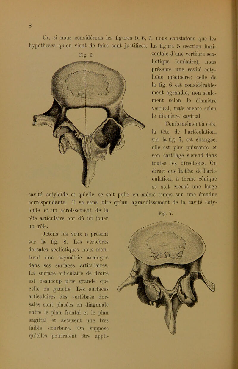 Or, si nous considérons les ligures 5, G, 7, nous constatons que les hypothèses qu’on vient de faire sont justifiées. La ligure 5 (section hori- Fig. 6. zontale d’une vertèbre sco- liotique lombaire), nous présente une cavité cotj'- loïde médiocre; celle de la fig. 6 est considérable- ment agrandie, non seule- ment selon le diamètre vertical, mais encore selon le diamètre sagittal. Conformément à cela, la tète de l’articulation, sur la fig. 7, est changée, elle est plus puissante et son cartilage s’étend dans toutes les directions. On dirait que la tête de l’arti- culation, à forme conique se soit creusé une large cavité cotjloïde et qu’elle se soit polie en même temps sur une étendue correspondante. Il va sans dire qu’un agrandissement de la cavité coty- loïde et un acroissement de la tête articulaire ont dû ici jouer un rôle. Jetons les yeux à présent sur la fig. 8. Les vertèbres dorsales scoliotiques nous mon- trent une asymétrie analogue dans ses surfaces articulaires. La surface articulaire de droite est beaucoup plus grande que celle de gauche. Les surfaces articulaires des vertèbres dor- sales sont placées en diagonale entre le plan frontal et le plan sagittal et accusent une très faible courbure. On suppose qu’elles pourraient être appli- Fis. 7.