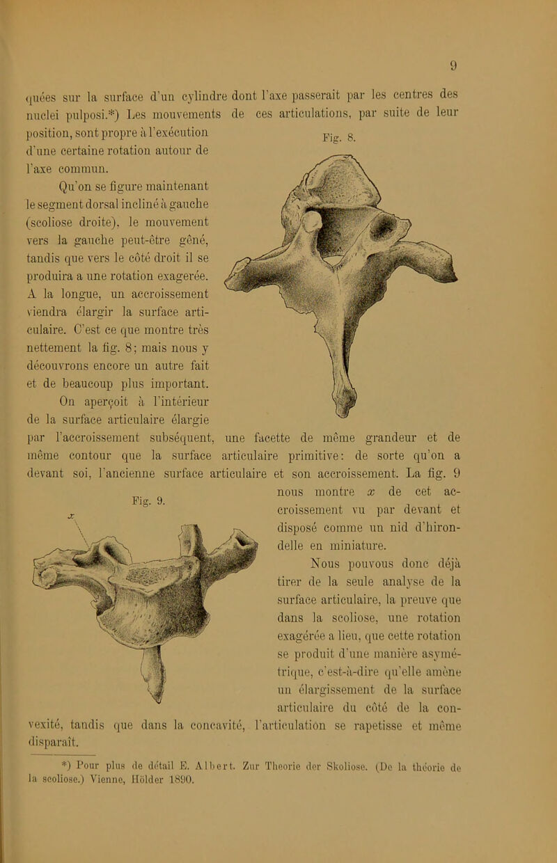 ((liées sur la surface d’un cylindre dont l’axe passerait par les centres des nuclei pulposi.*) Les mouvements de ces articulations, par suite de leur (losition, sont propre à l’exécution d'une certaine rotation autour de l’axe commun. Qu’on se figure maintenant le segment dorsal incliné à gauche (scoliose droite), le mouvement vers la gauche peut-être gêné, tandis que vers le côté droit il se produira a une rotation exagerée. A la longue, un accroissement viendra élargir la surface arti- culaire. C’est ce que montre très nettement la fig. 8; mais nous y découvrons encore un autre fait et de beaucoup plus important. On aperçoit à l’intérieur de la surface articulaire élargie par l’accroissement subséquent, une facette de même grandeur et de même contour que la surface articulaire primitive: de sorte qu’on a devant soi, l’ancienne surface articulaire et son accroissement. La fig. 9 nous montre x de cet ac- Fia:. 9. croissement vu par devant et disposé comme un nid d’hiron- delle en miniature. Nous pouvons donc déjà tirer de la seule analyse de la surface articulaire, la preuve que dans la scoliose, une rotation exagérée a lieu, que cette rotation se produit d’une manière asymé- tri((ue, c’est-à-dire qu’elle amène un élargissement de la surface articulaire du côté de la con- vexité, tandis que dans la concavité, l’articulation se rapetisse et même disparaît. '*■•) Pour plus lie detail E. Albert. Zur Théorie dor Skoliose. (Do la théorie de la scoliose.) Vienne, Hôlder 1890.