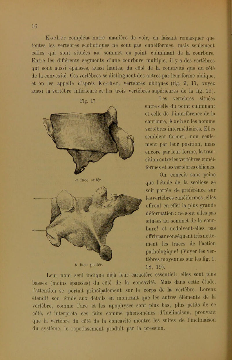 Ko cher compléta notre manière de voir, en faisant remarquer que toutes les vertèbres scoliotiques ne sont pas cunéiformes, mais seulement celles qui sont situées au sommet ou point culminant de la courbure. Entre les différents segments d’une courbure multiple, il y a des vertèbres qui sont aussi épaisses, aussi hautes, du coté de la concavité que du côté de la convexité. Ces vertèbres se distinguent des autres par leur forme oblique, et on les appelle d’après Kocher, vertèbres obliques (fig. 9, 17, voyez aussi la vertèbre inférieure et les trois vertèbres supérieures de la fig. 19). Les vertèbres situées entre celle du point culminant et celle de l’interférence de la courbure, Kocher les nomme vertèbres intermédiaires. Elles semblent former, non seule- ment par leur position, mais encore par leur forme, la tran- sition entre les vertèbres cunéi- formes et les vertèbres obliques. On conçoit sans peine que l’étude de la scoliose se soit portée de préférénce sui- tes vertèbres cunéiformes ; elles offrent en effet la plus grande déformation; ne sont elles pas situées au sommet de la cour- bure! et nedoivent-elles pas offrir par conséquent très nette- ment les traces de l’action pathologique! (Voyer les ver- tèbres moyennes sur les fig. 1. 18, 19). Fig. 17. a face antér. h face poster. Leur nom seul indique déjà leur caractère essentiel: elles sont plus basses (moins épaisses) du côté de la concavité. IMais dans cette étude, l’attention se portait principalement sur le corps de la vertèbre. Lorenz étendit son étude aux détails en montrant que les autres éléments de la vertèbre, comme l’arc et les apophyses sont plus bas, plus petits de ce côté, et interpréta ces faits comme phénomènes d’inclinaison, prouvant que la vertèbre du côté de la concavité montre les suites de l inelinaison du système, le rapetissement produit par la pression.