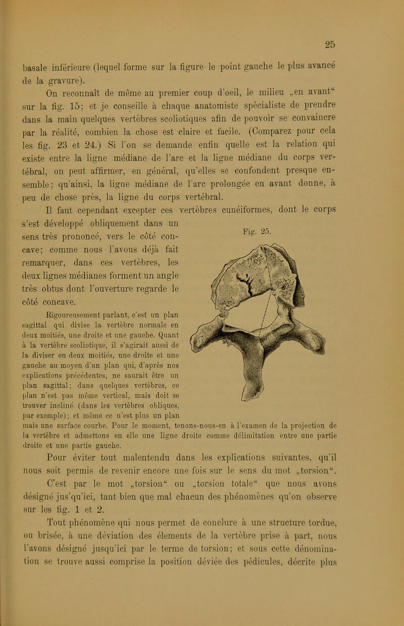 basale inférieure (lequel forme sur la figure le point gauche le plus avancé de la gravure). On reconnaît de môme au premier coup d’oeil, le milieu „en avant sur la fig. 15; et je conseille à chaque anatomiste spécialiste de prendre dans la main quelques vertèbres scoliotiques afin de pouvoir se convaincre par la réalité, combien la chose est claire et facile. (Comparez pour cela les fig. 23 et 24.) Si l’on se demande enfin quelle est la relation qui existe entre la ligne médiane de l’arc et la ligne médiane du corps ver- tébral, on peut affirmer, en général, qu’elles se confondent presque en- semble; qu’ainsi, la ligne médiane de l’arc prolongée en avant donne, à peu de chose près, la ligne du corps vertébral. Il faut cependant excepter ces vertèbres cunéiformes, dont le corps s’est développé obliquement dans un sens très prononcé, vers le côté con- cave; comme nous l’avous déjà fait remarquer, dans ces vertèbres, les deux lignes médianes forment un angle très obtus dont l’ouverture regarde le côté concave. Rigoureusement parlant, c’est un plan sagittal qui divise la vertèbre normale en deux moitiés, une droite et une gauche. Quant à la vertèbre seoliotique, il s’agirait aussi de la diviser en deux moitiés, une droite et une gauche au moyen d’un plan qui, d’après nos explications précédentes, ne saurait être un plan sagittal; dans quelques vertèbres, ce plan n’est pas môme vertical, mais doit se trouver incliné (dans les vertèbres obliques, par exemple) ; et même ce n’est plus un plan mais une surface courbe. Pour le moment, tenons-nous-en à l’examen de la projection de la vertèbre et admettons en elle une ligne droite comme délimitation entre une partie droite et une partie gauche. Pour éviter tout malentendu dans les explications suivantes, qu’il nous soit permis de revenir encore une fois sur le sens du mot „torsion“. C’est par le mot „torsion“ ou „torsion totale que nous avons désigné jus’qu’ici, tant bien que mal chacun des phénomènes qu’on observe sur les fig. 1 et 2. Tout phénomène qui nous permet de conclure îi une structure tordue, ou brisée, à une déviation des éléments de la vertèbre jirise à part, nous l’avons désigné jusqu’ici par le terme de torsion; et sous cette dénomina- tion se trouve aussi comprise la position déviée des pédicules, décrite plus Fig. 25.